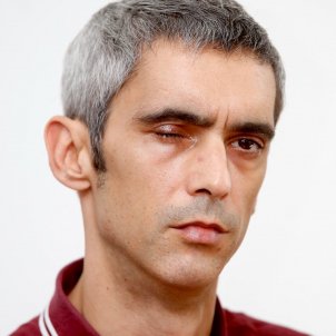 Roger Español, who lost an eye during the Catalan referendum, placed under investigation Roger Español, who lost an eye during the Catalan referendum, placed under investigation