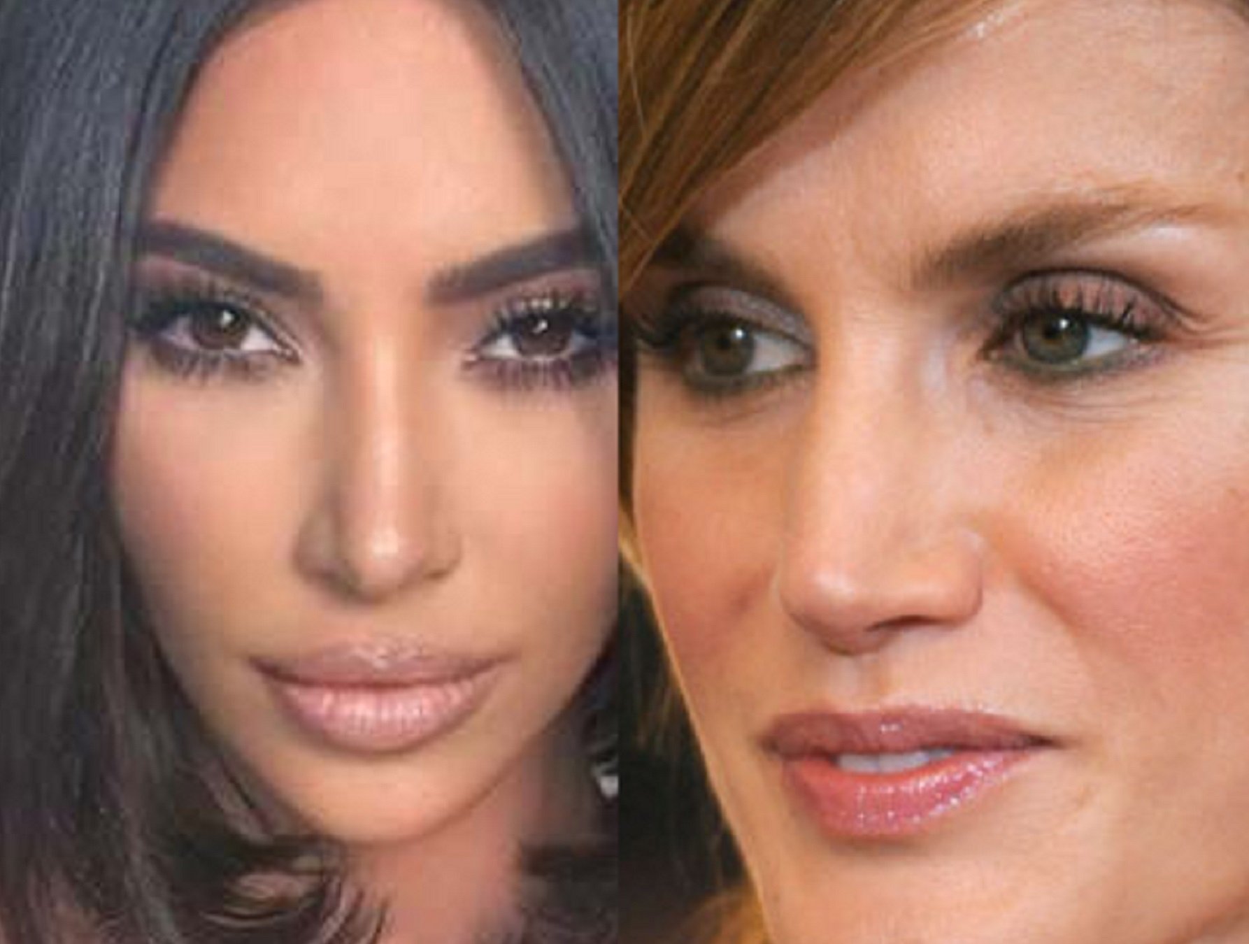 INSÒLIT Això s'operen els espanyols per semblar-se a Letícia i Kim Kardashian