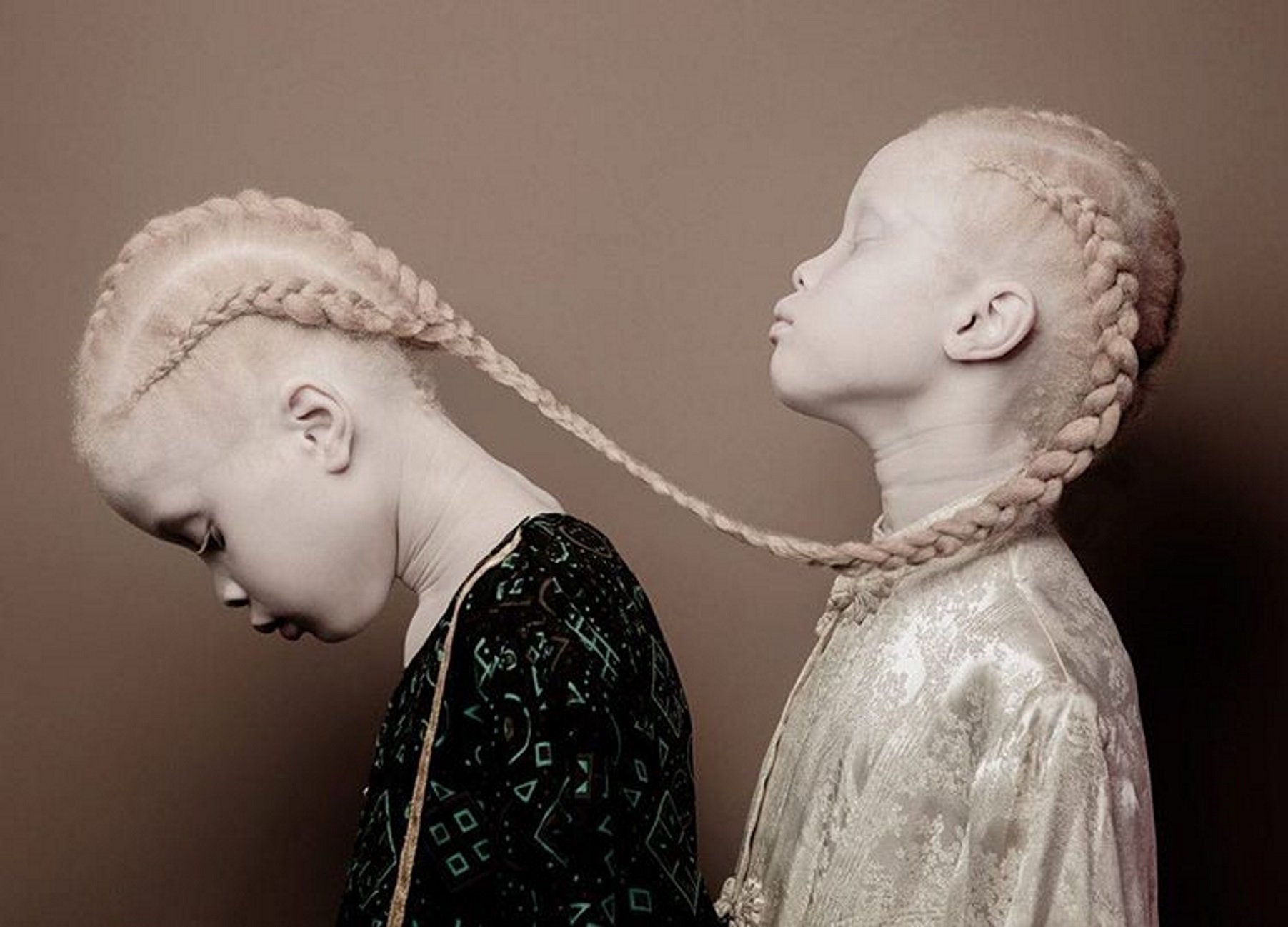 Las gemelas albinas que han revolucionado el mundo de la moda