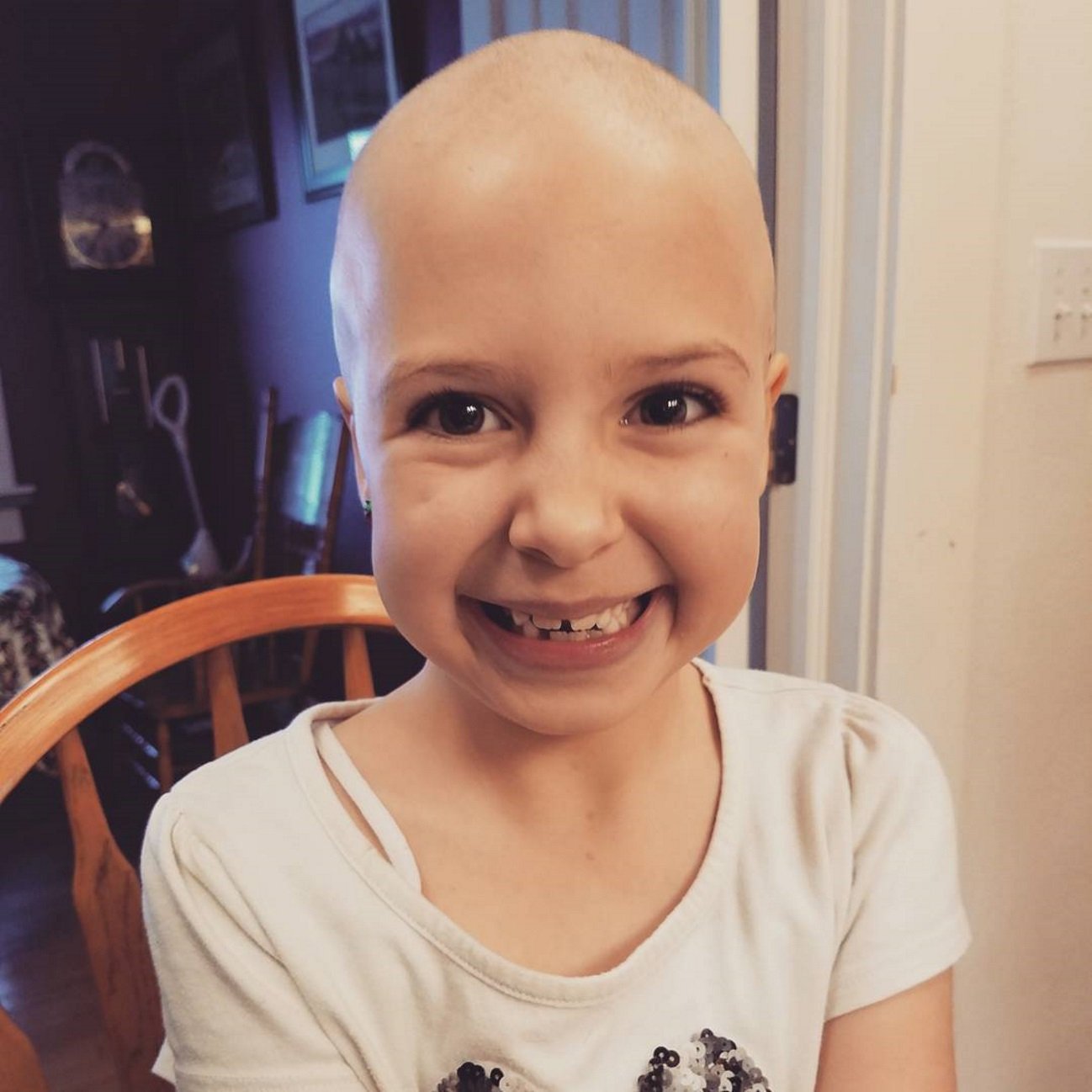 El gran ejemplo de superación de una niña de siete años con alopecia
