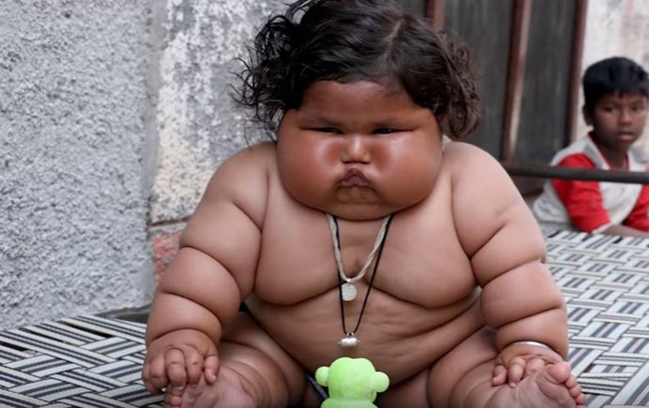 El increíble caso de Chachat: la niña de sólo 8 meses que pesa 17 kilos
