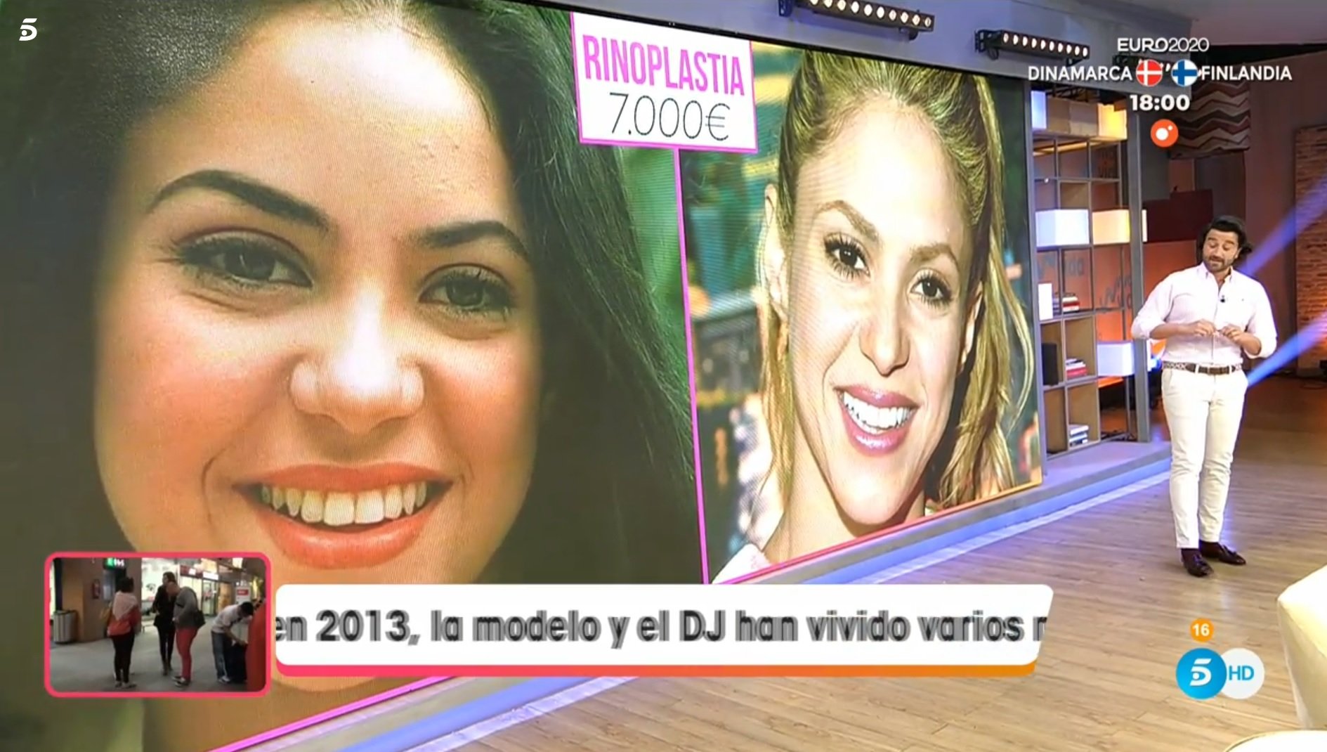 Shakira, su antes y después con cirugía estética: 65 mil euros según Telecinco
