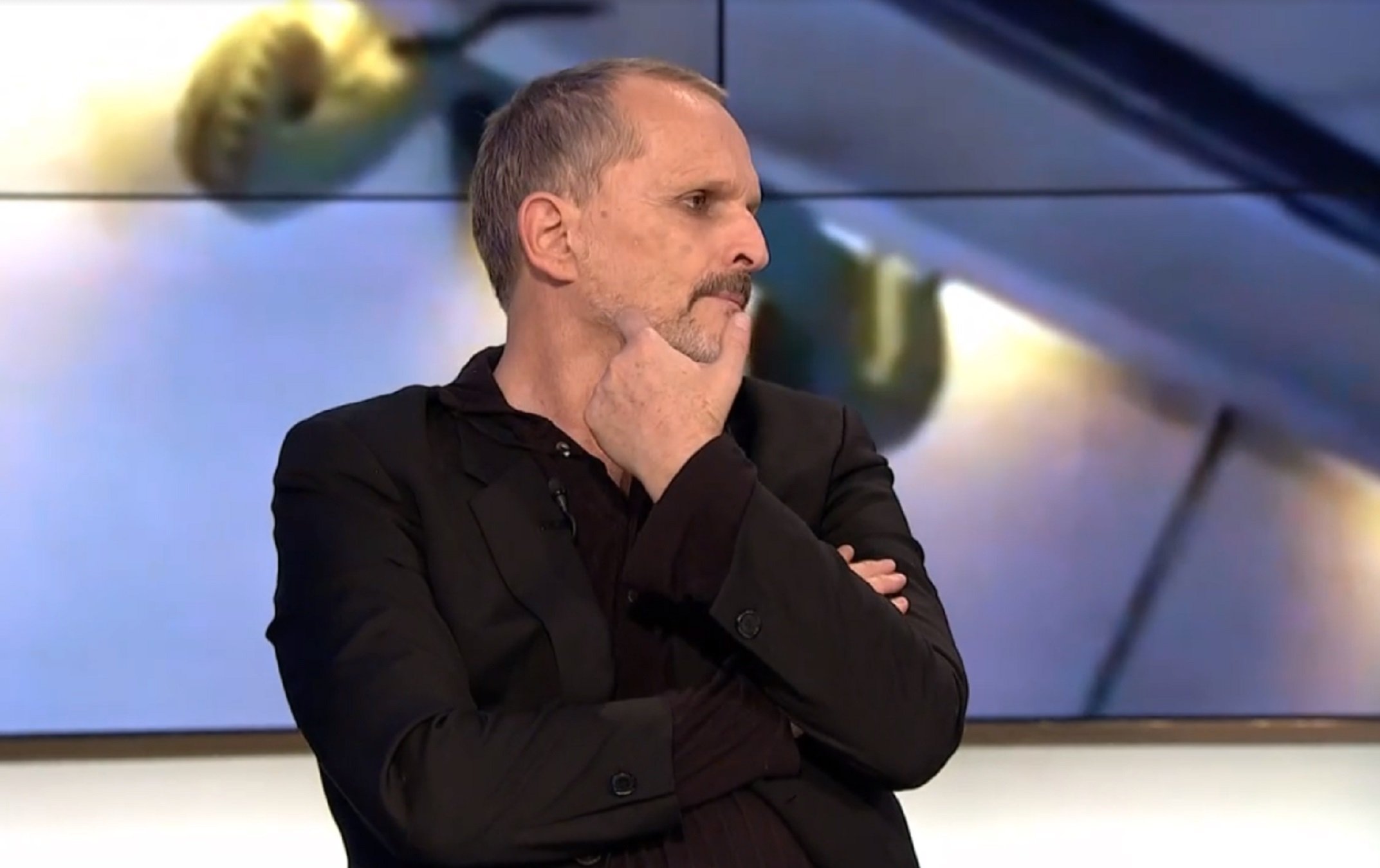 Miguel Bosé, confesando en TVE el sorprendente origen de la cicatriz de su cara