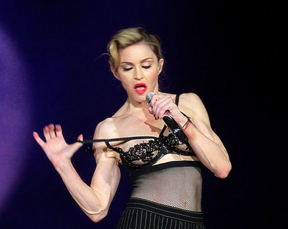 Exageració, impacte amb l'última operació de Madonna: "S'ha posat més que Kim Kardashian"