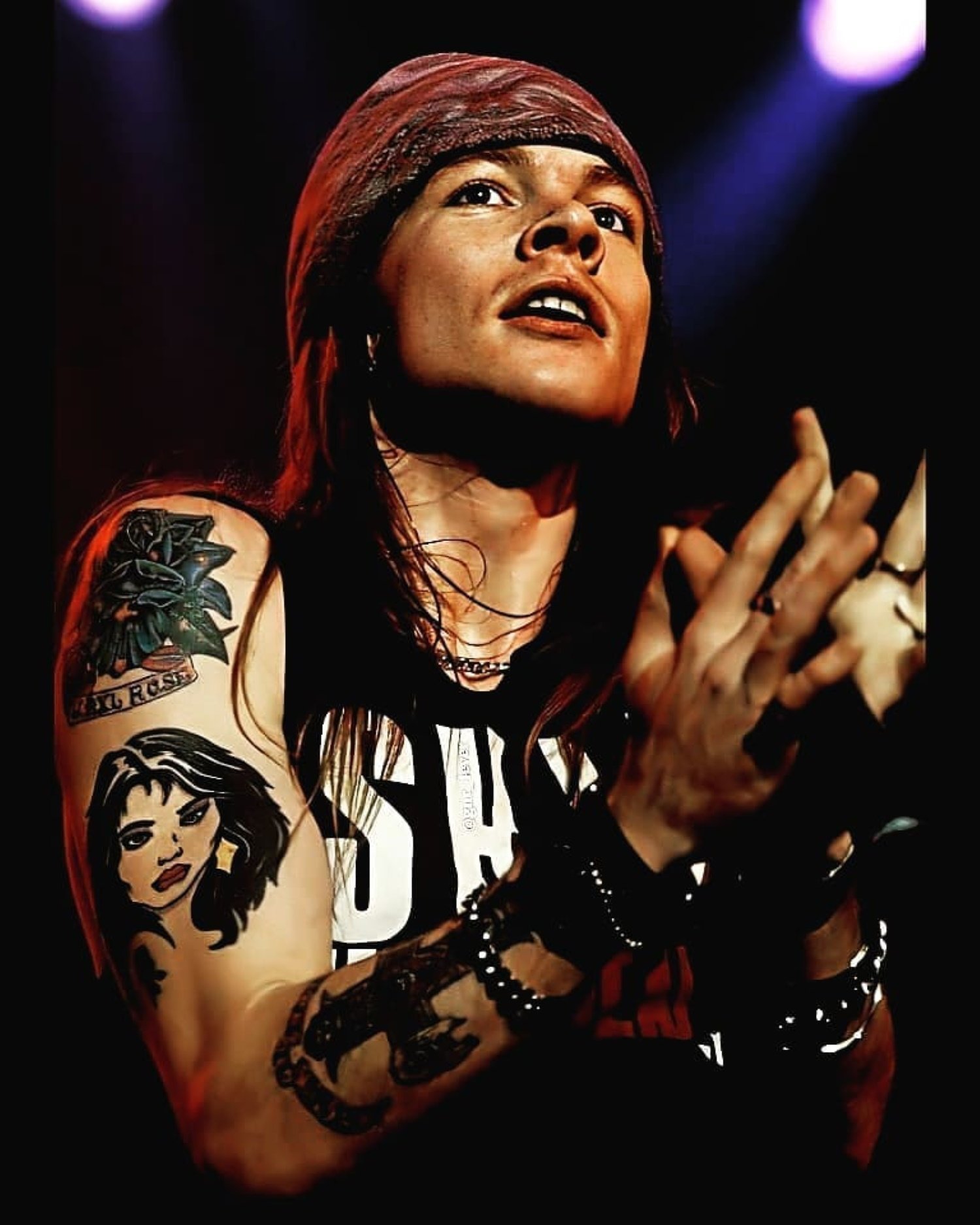 Axl Rose deja en shock: irreconocible, hinchado, injerto naranja, hiere a una fan con un micro