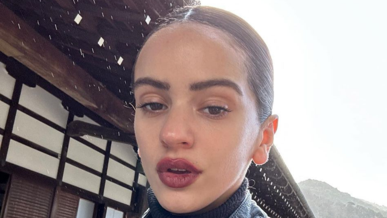 Impacto brutal al ver los nuevos labios de Rosalía: "Te has pasado con el relleno"