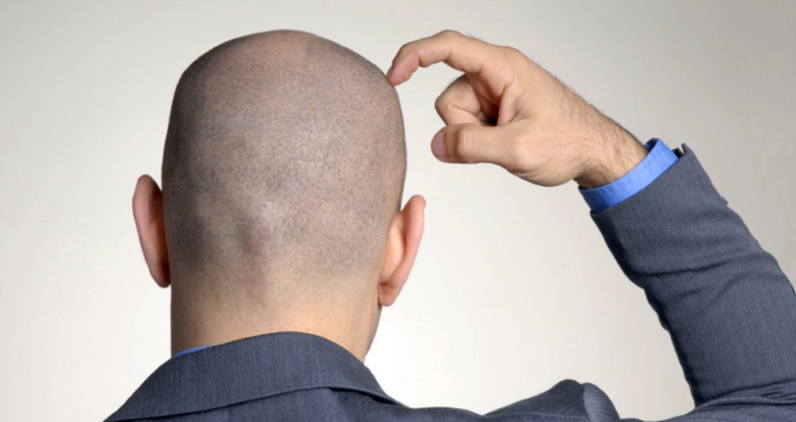 Un catalán muy VIP con refinado tupé sorprende revelando su alopecia: "Estoy en las mejores manos"