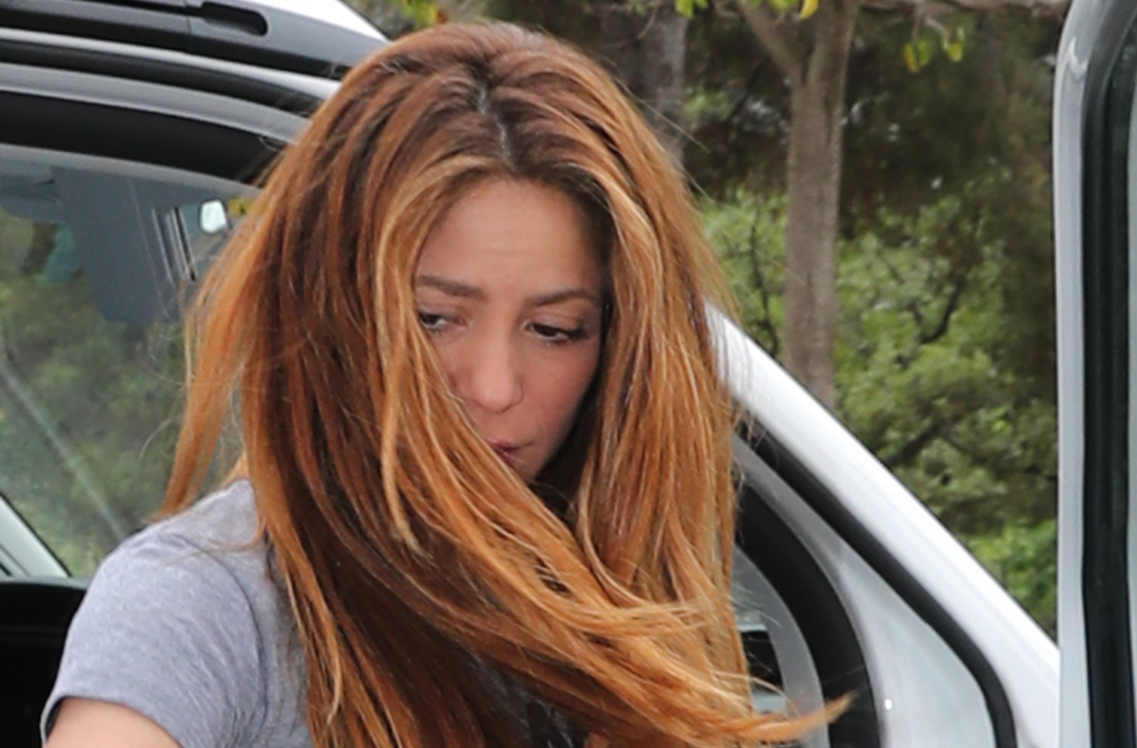 Shakira es posa morros nous: no sembla ella. La clínica de Pedralbes on va a punxar-se