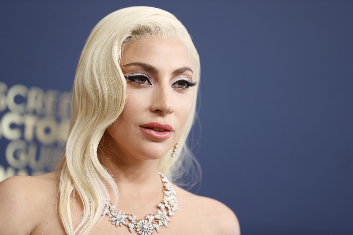 Lady Gaga, impacte, nova boca i dents, irreconeixible