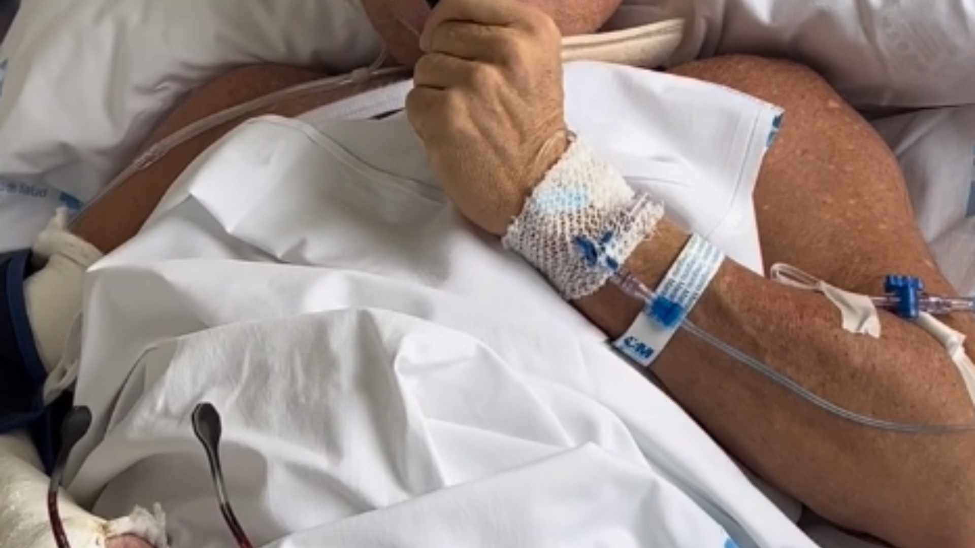 Famós de TV ingressat, molt greu per un accident de moto, vídeo a l'hospital