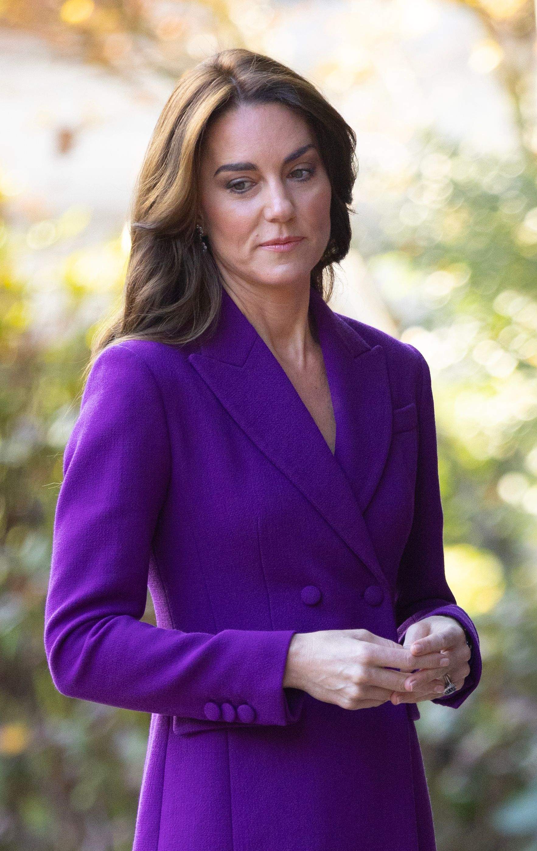 Kate Middleton es nega a posar-se perruca per la caiguda de cabell