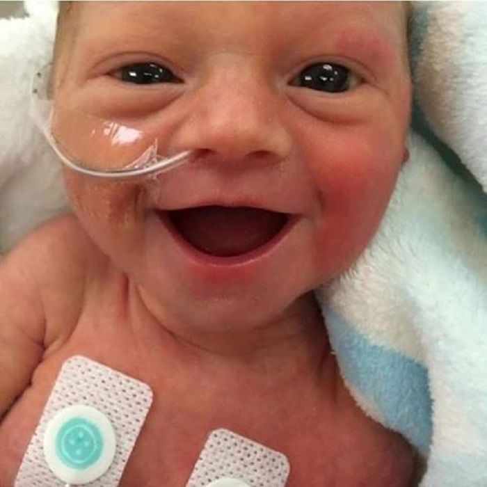 La encantadora sonrisa de un bebé prematuro con sólo cinco días de vida