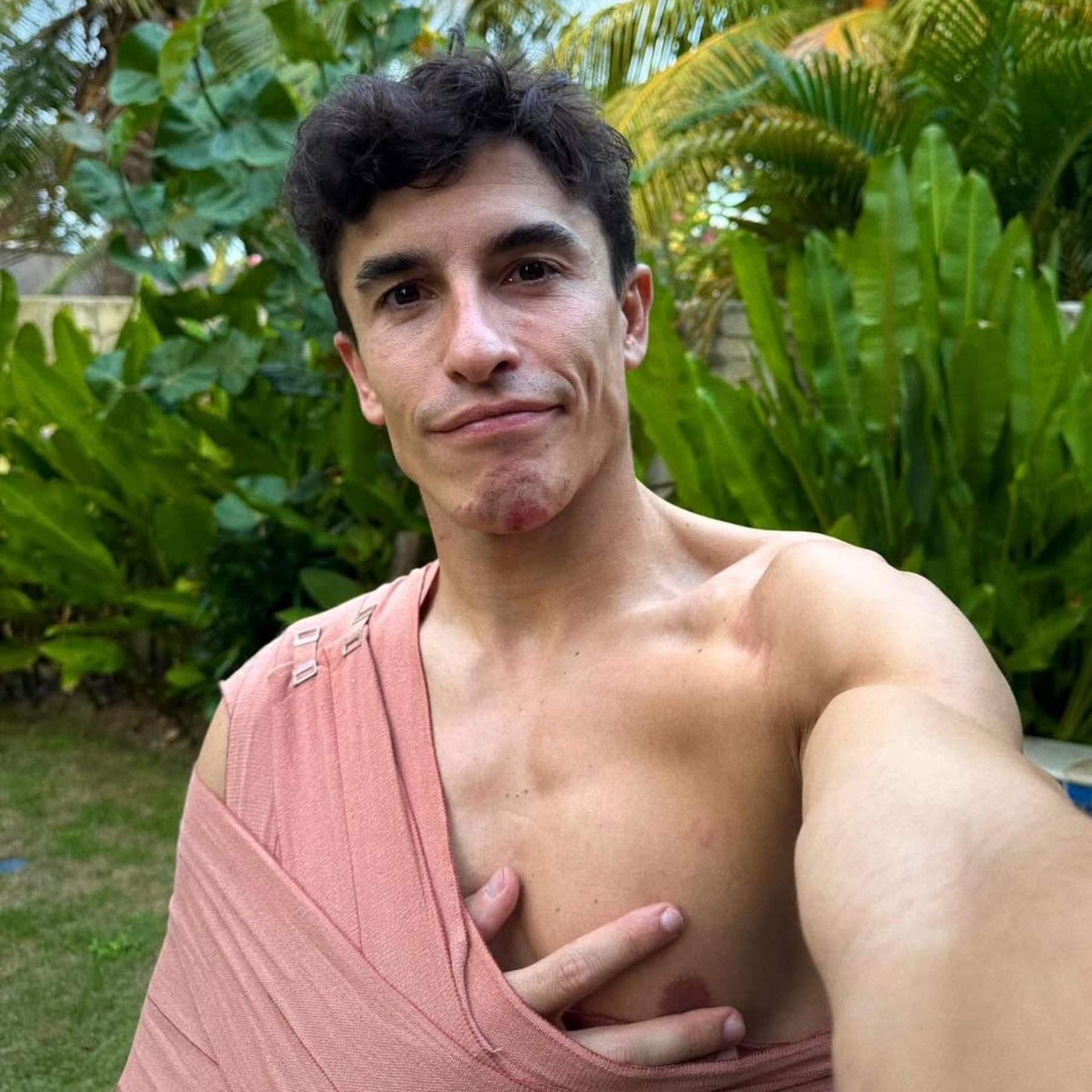 Marc Márquez emociona con Gemma, su pareja, foto juntos: así se recupera de la lesión