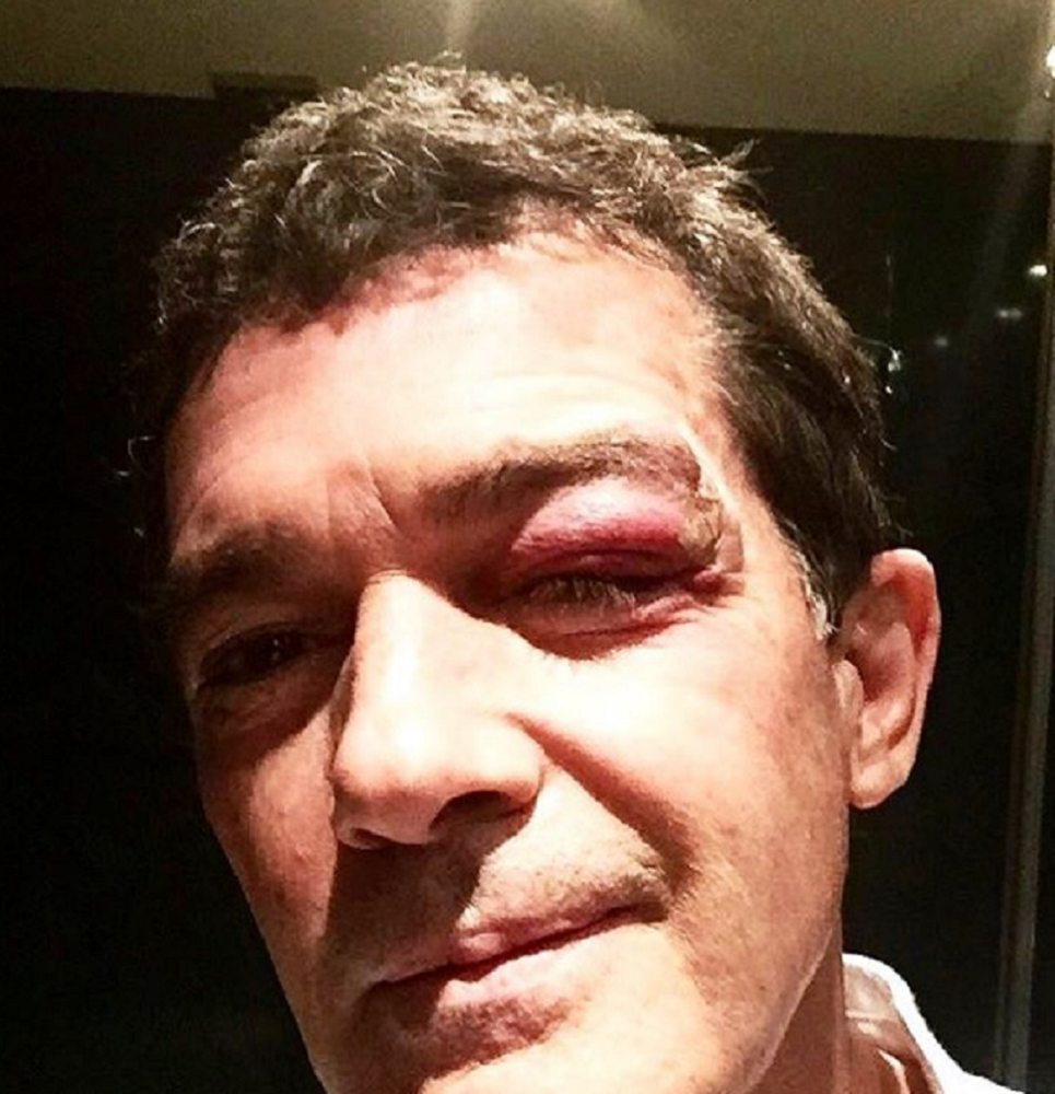La cara de Antonio Banderas tras sufrir un accidente mientras rodaba