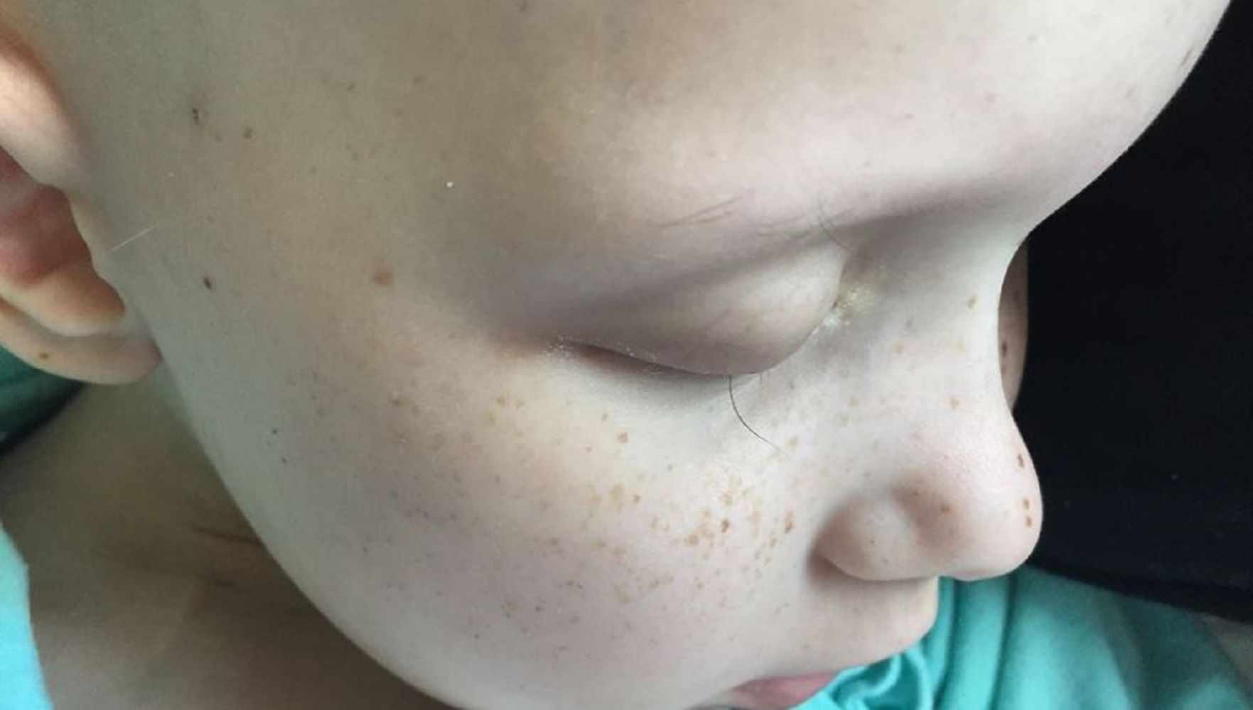 L'última pestanya d'una nena de set anys que lluita contra el càncer