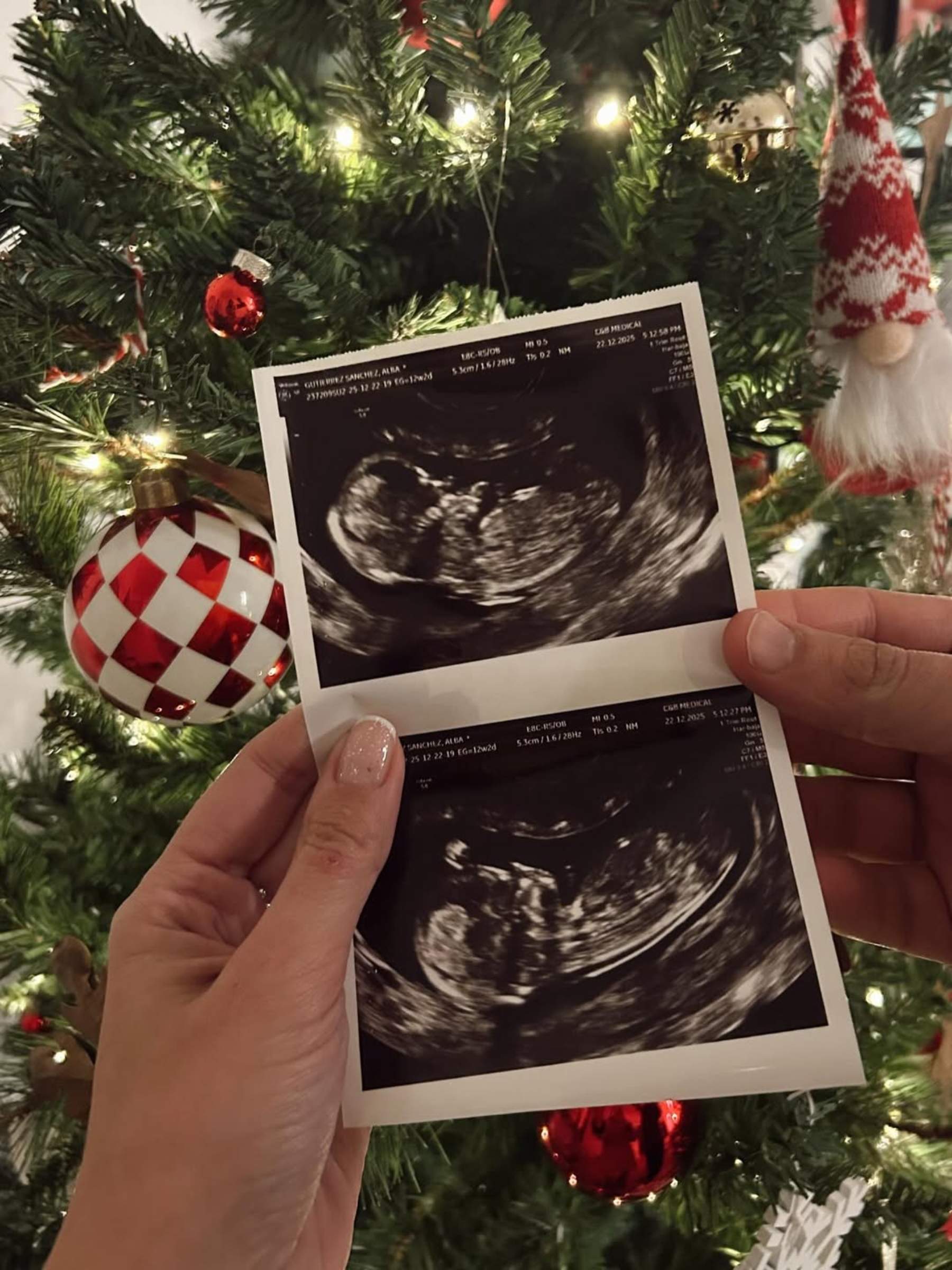 Pareja de comunicadores catalanes desvelan que serán padres de nuevo: "Hace semanas que pensamos en el 2026"