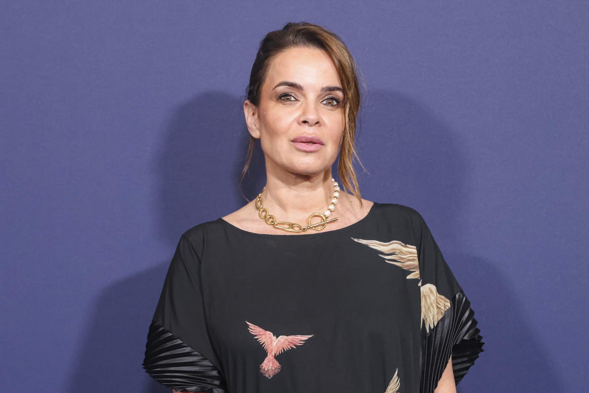 Foto impactant de Carme Chaparro, perd els cabells per una malaltia: "No és càncer"