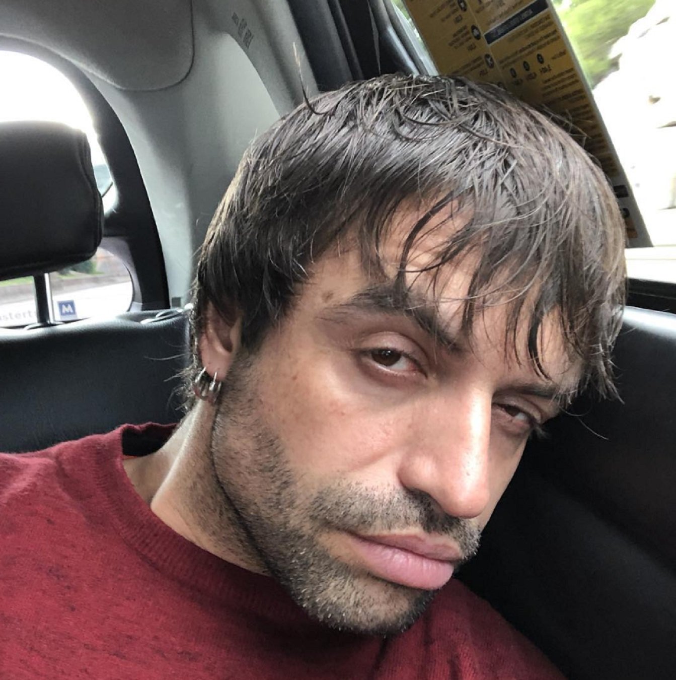 Manu Guix sorprèn els fans revelant que l'han hagut d'operar