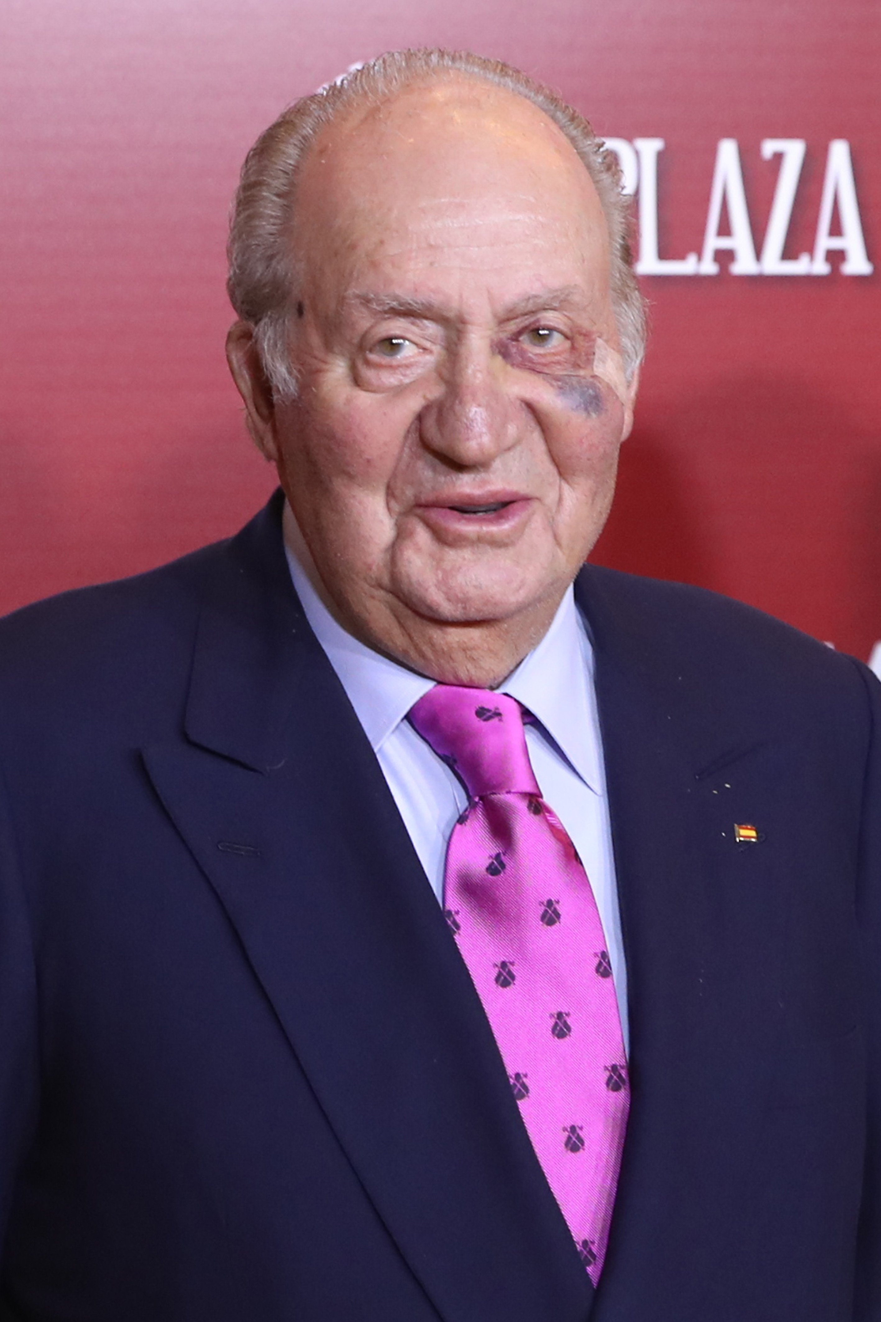 La cara nova de Joan Carles dispara especulacions: càncer de pell o estètica?