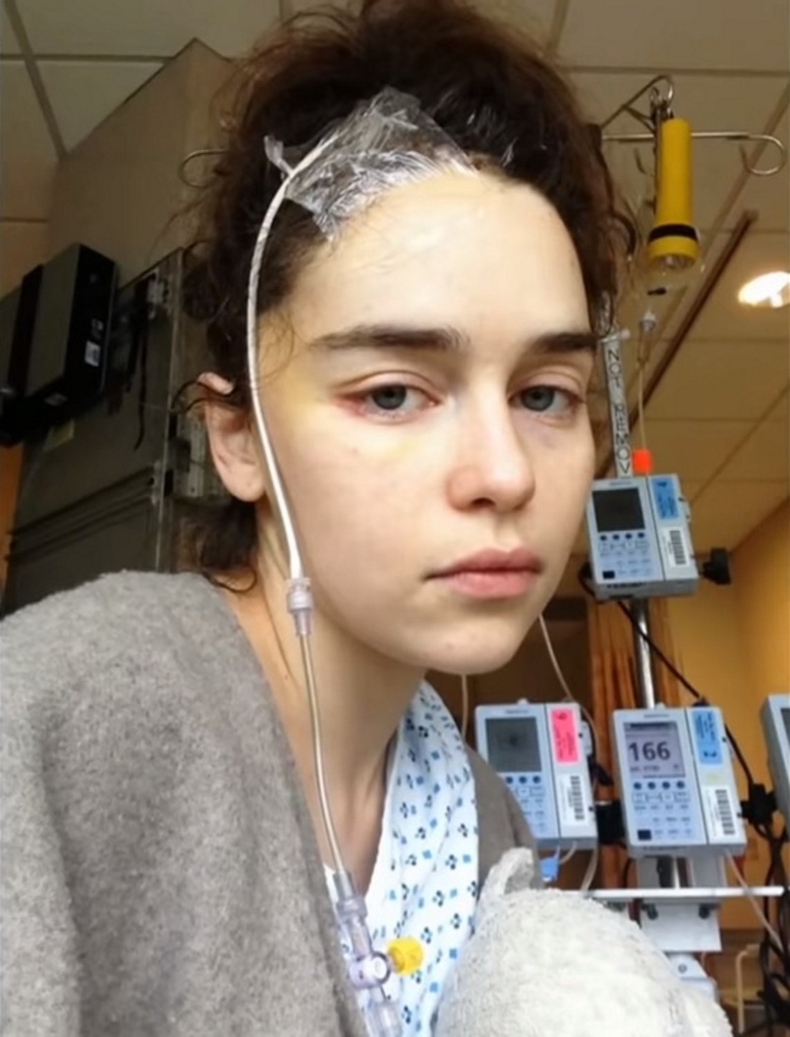 Emilia Clarke muestra las impactantes imágenes en el hospital, después del ictus