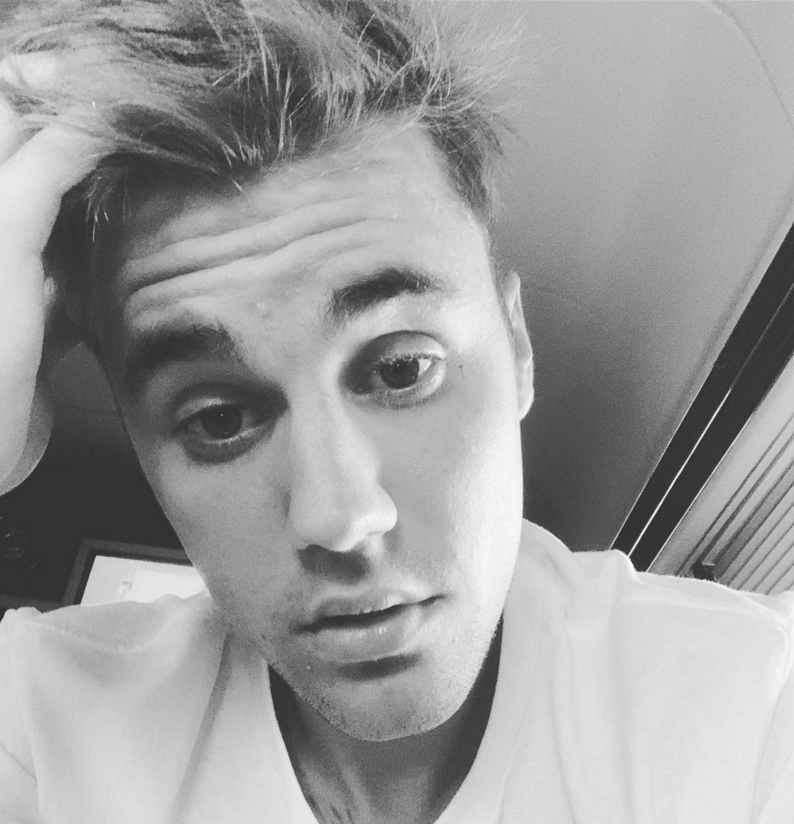 Justin Bieber tiene un problema: El acné "juvenil" (a sus 25 años)