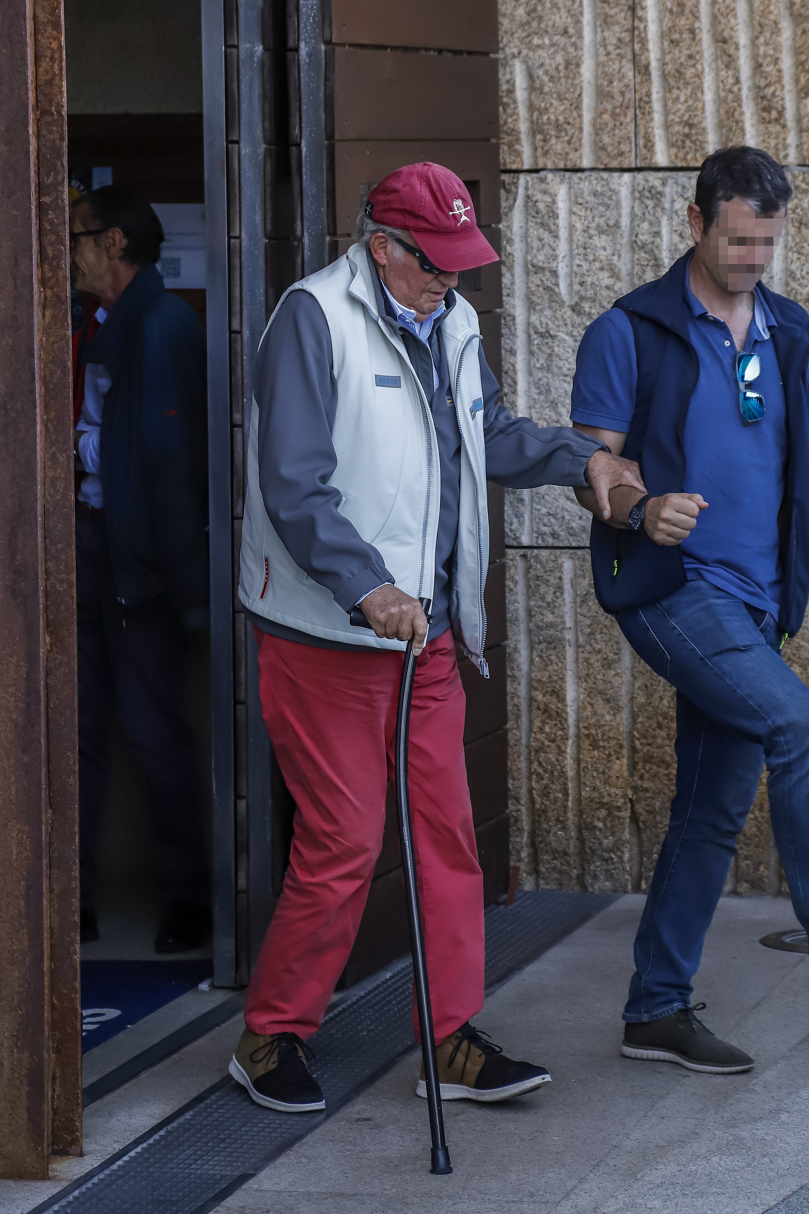 Foto horrorosa de la pierna deformada de Juan Carlos: no puede ni caminar