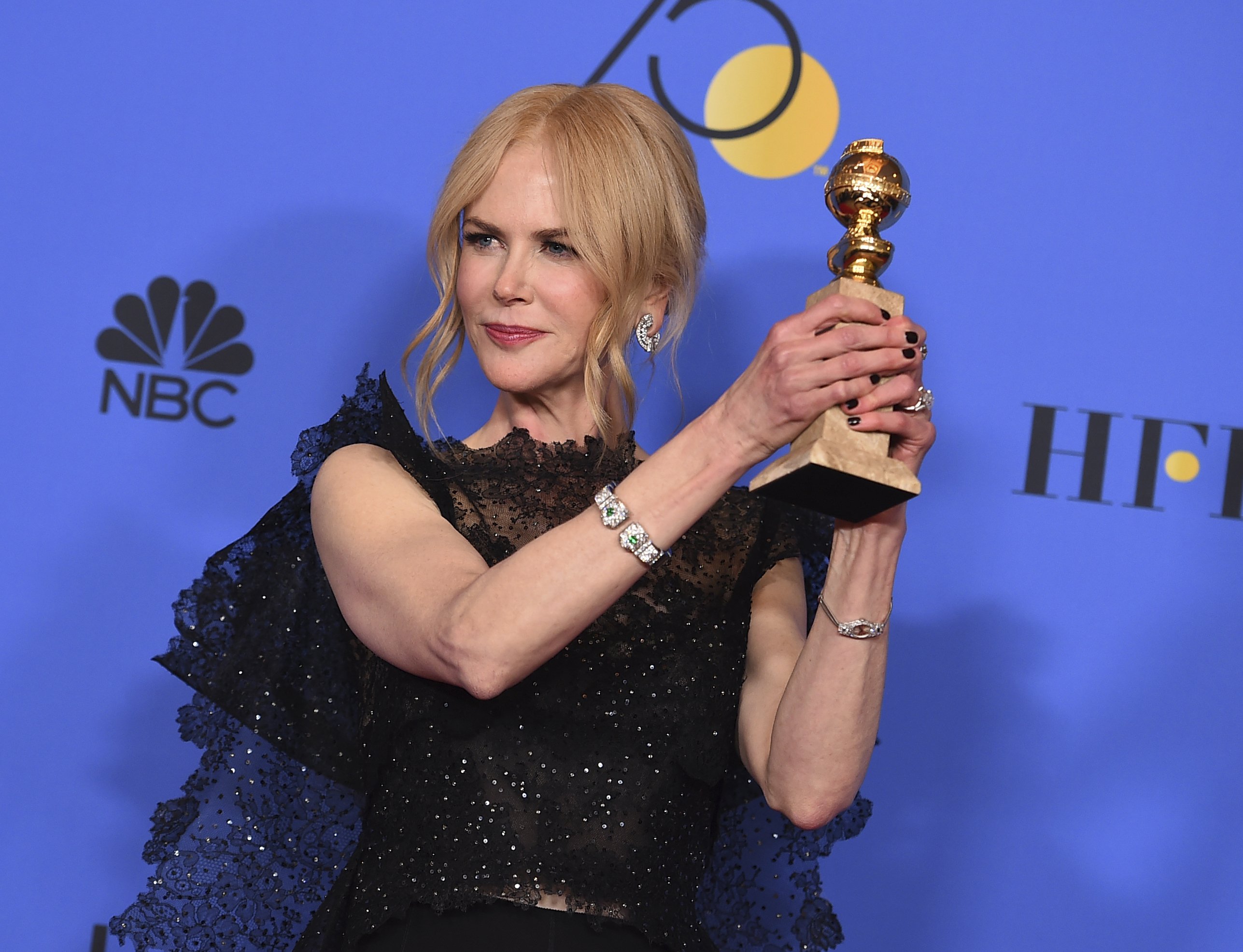 Nicole Kidman ja no és així: es passa amb el bisturí i li fan una cara nova