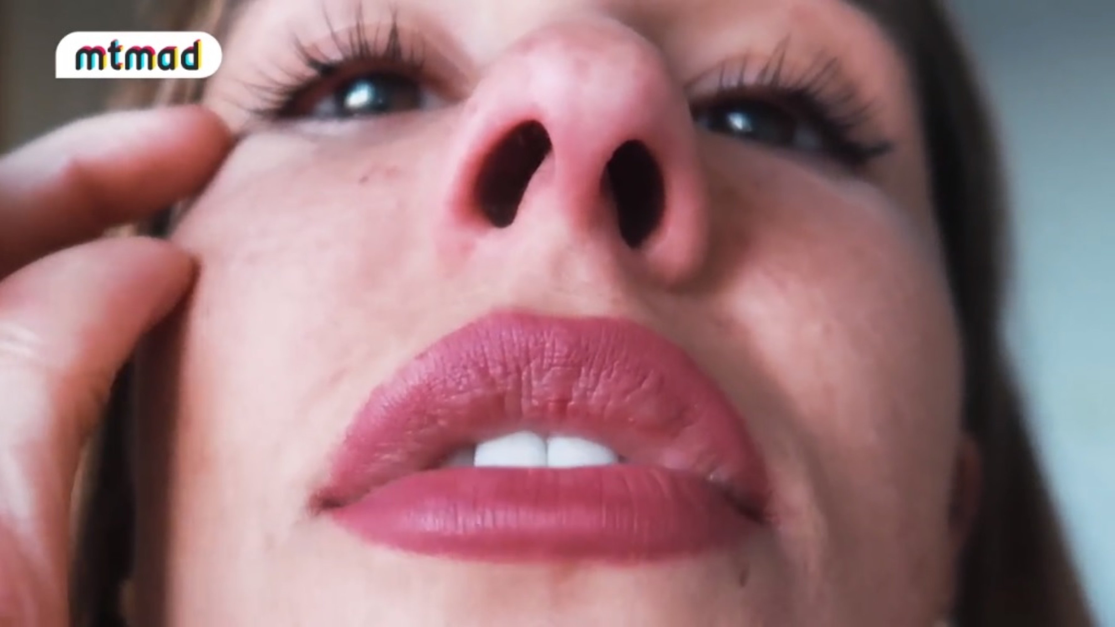 Una famosa de T5 llora después de hacerse la estética: "Mi cara es un cuadro"