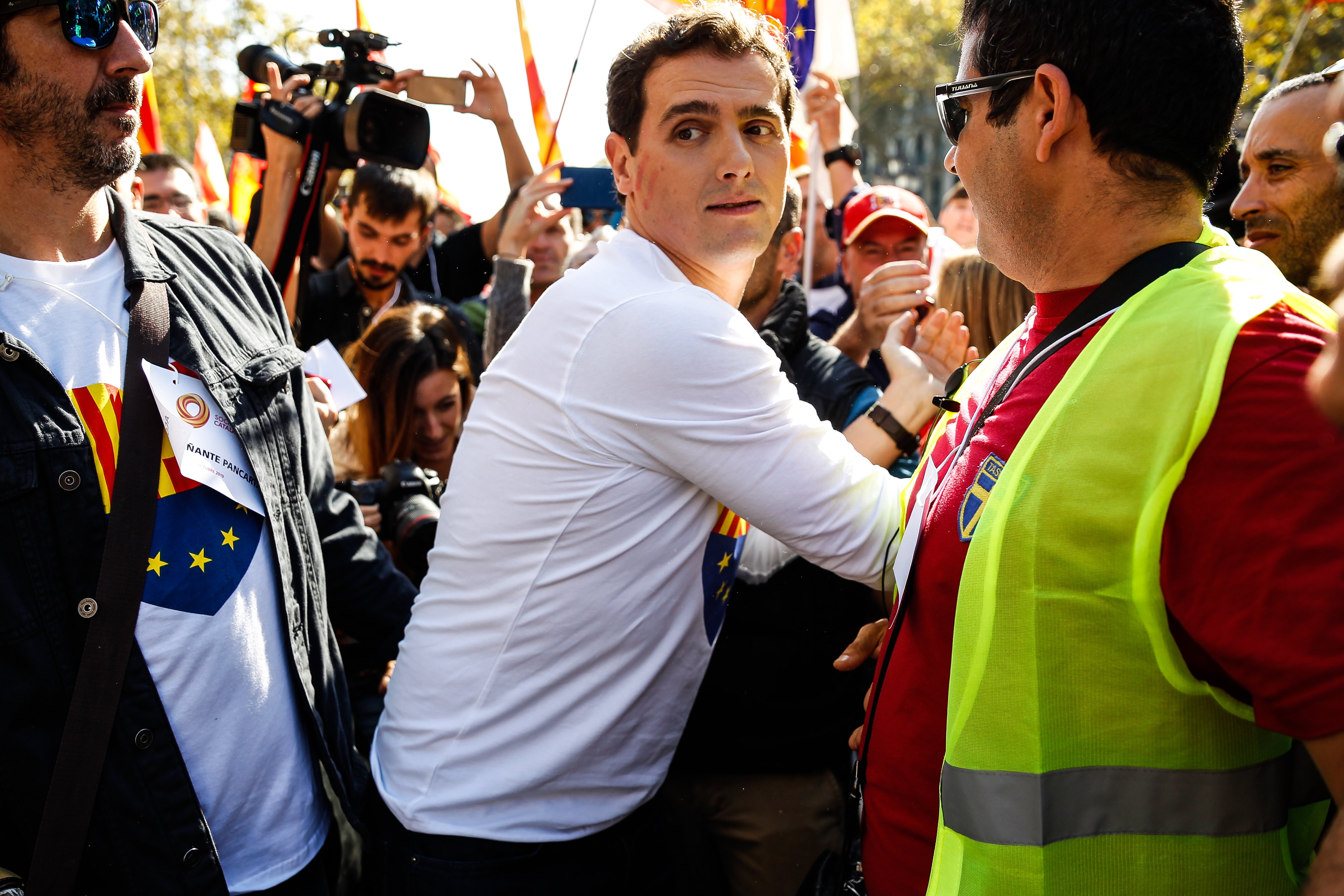 FOTO INÉDITA Albert Rivera está calvo, su trasplante fallido visto desde arriba