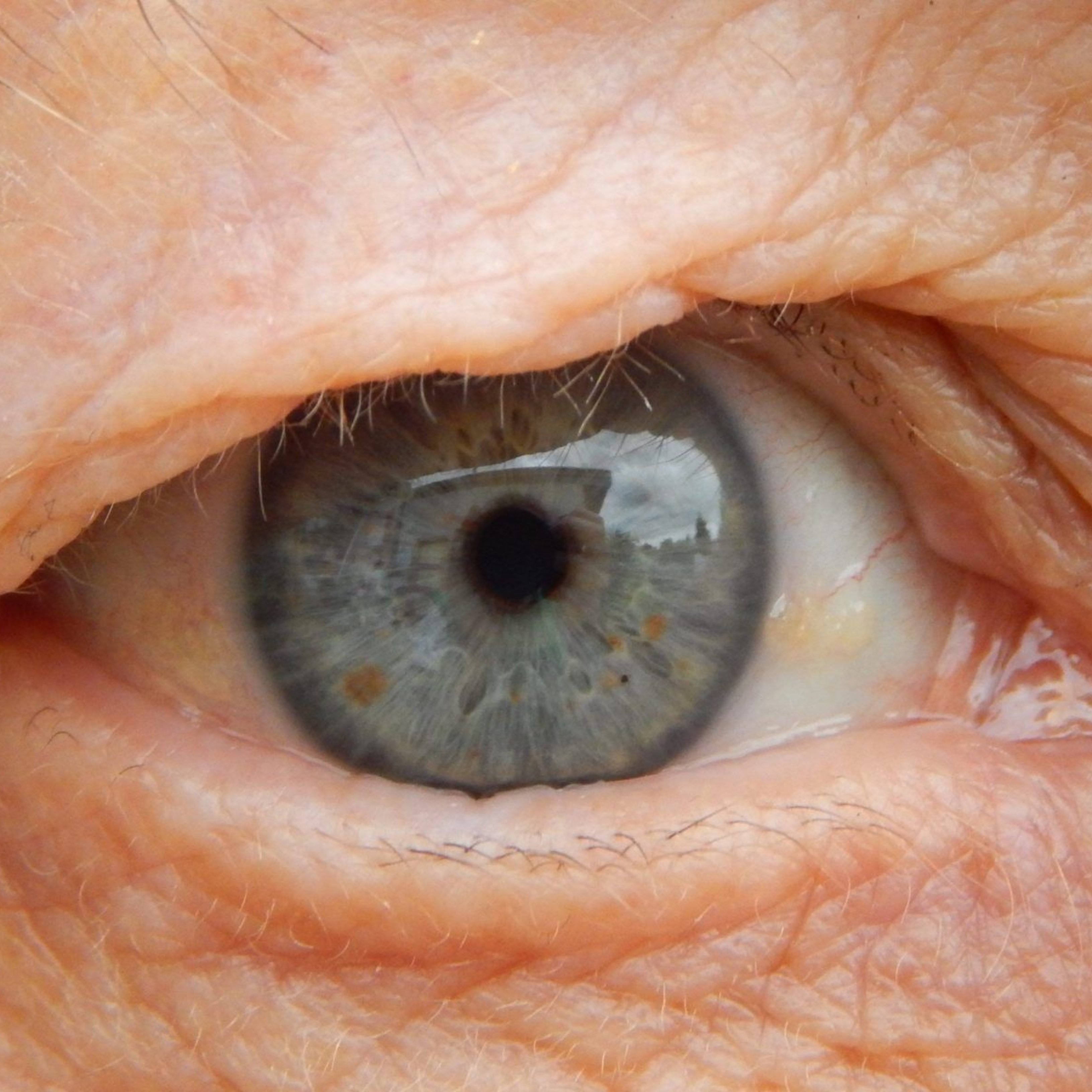 La degeneració macular, com prevenir-la i afrontar-la a partir dels 50