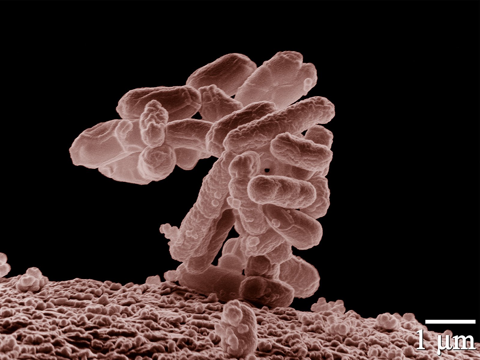 E Coli Wikipedia