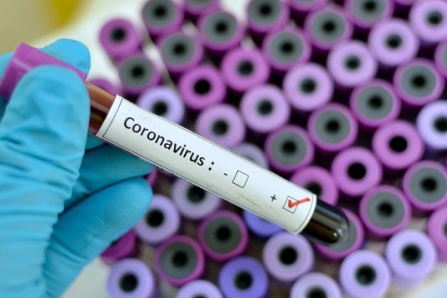Medicina Coronavirus investigació medica - Europa Press