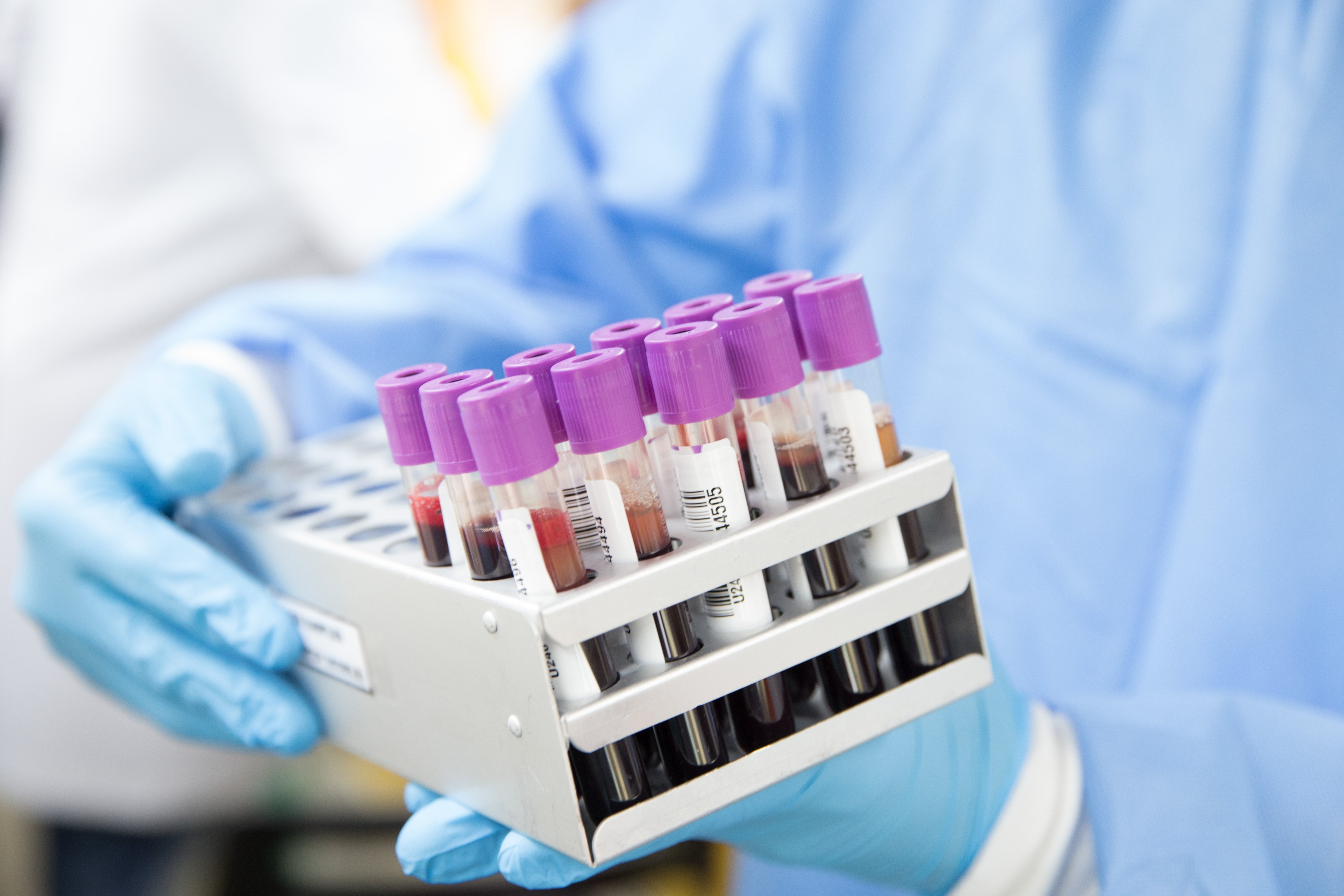 El Banc de Sang busca donantes de plasma que hayan superado el coronavirus