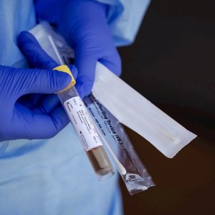 test coronavirus EFE