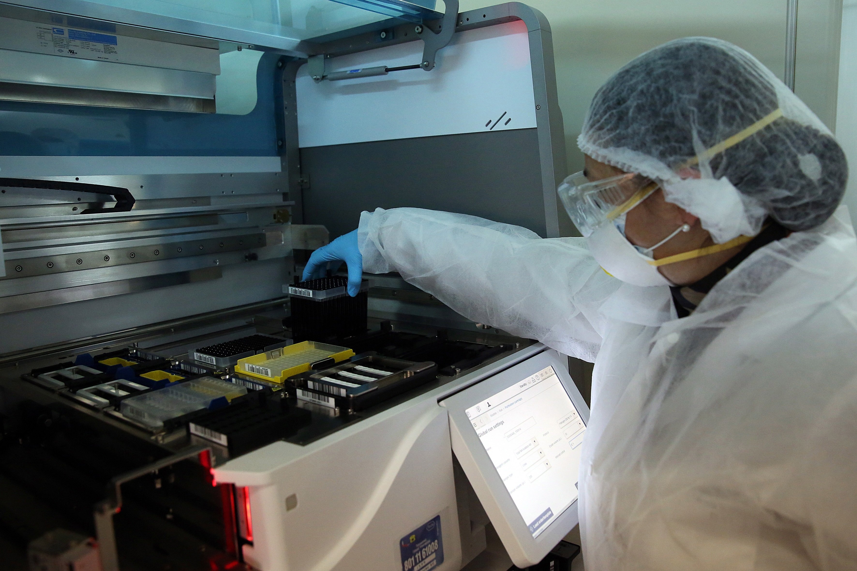 Ideen una tecnologia per diagnosticar el coronavirus i saber en quina etapa està