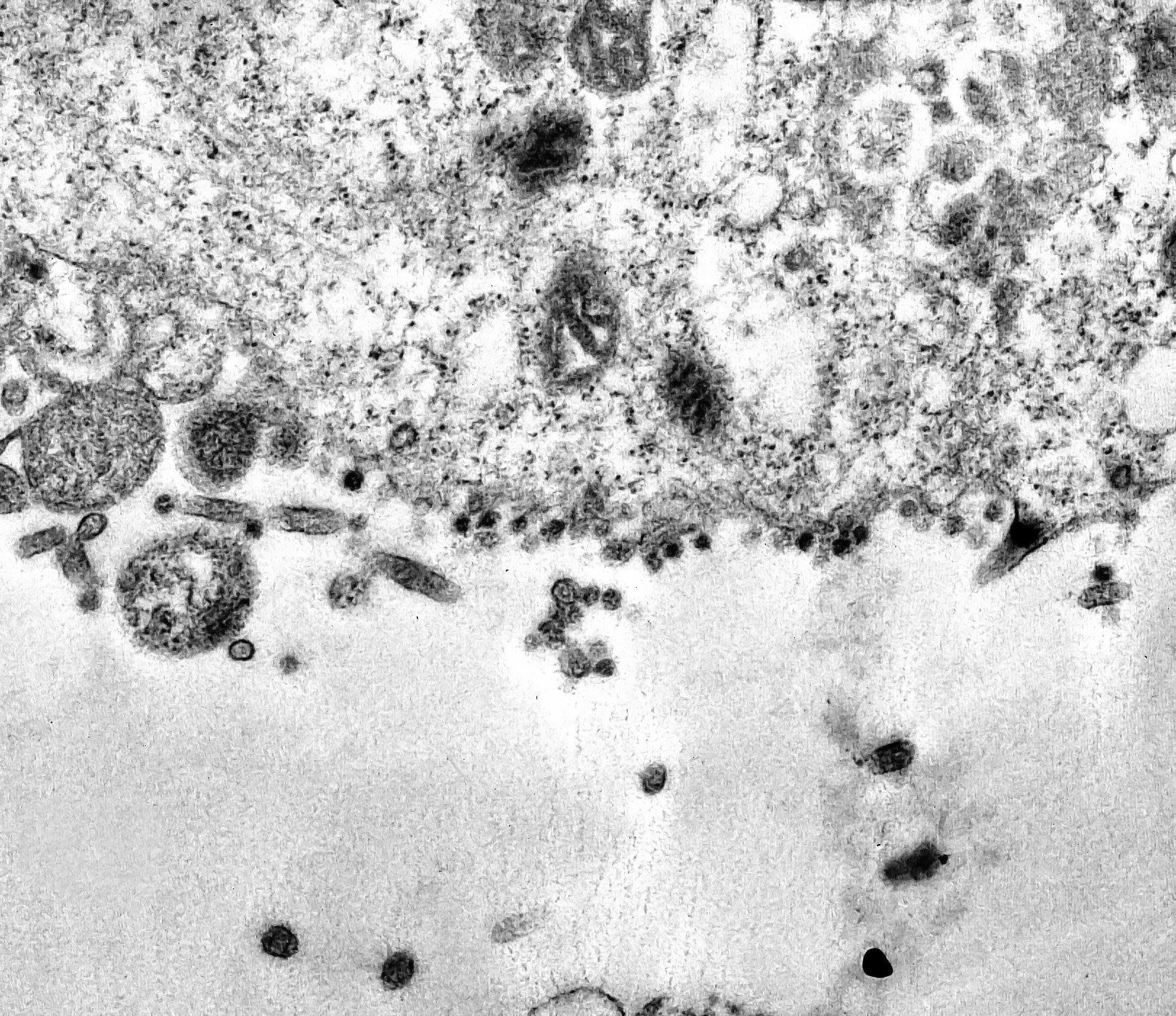 VÍDEO | Imágenes del momento exacto en que el coronavirus infecta una célula