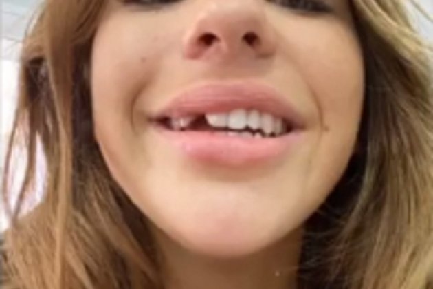 Anita Matamoros sin diente instagram