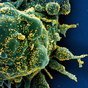 Microfotografia electrònica acolorida d'una cèl·lula apoptòtica (verda) molt infectada del virus del SARS COV 2 (groc) (NIAID)