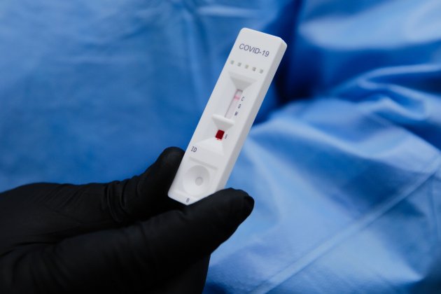 coronavirus test|tiesto anticuerpos efe