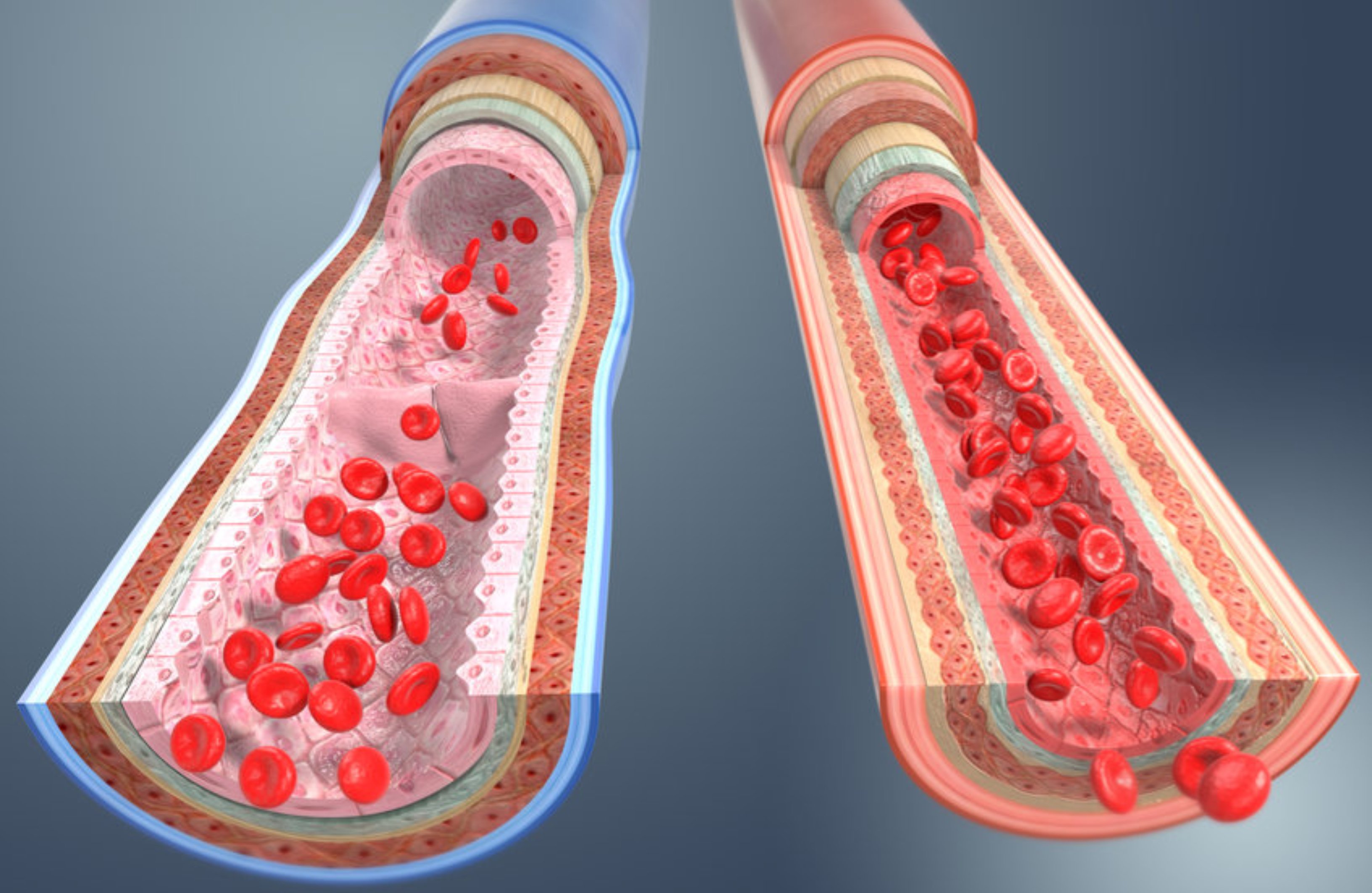 La aterosclerosis aumenta rápidamente en una franja de edad determinada