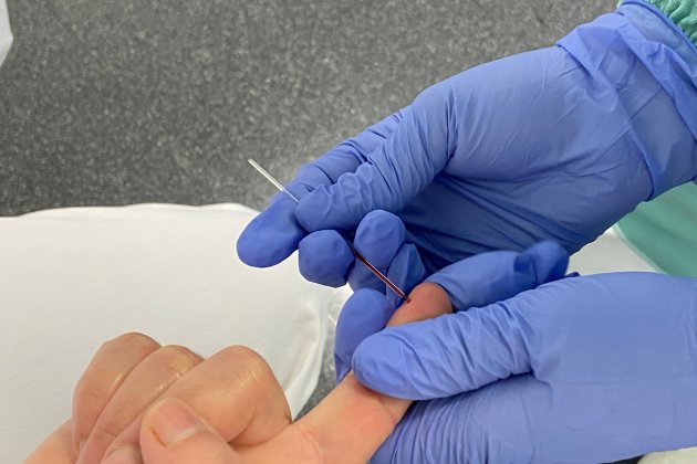 test coronavirus - acn