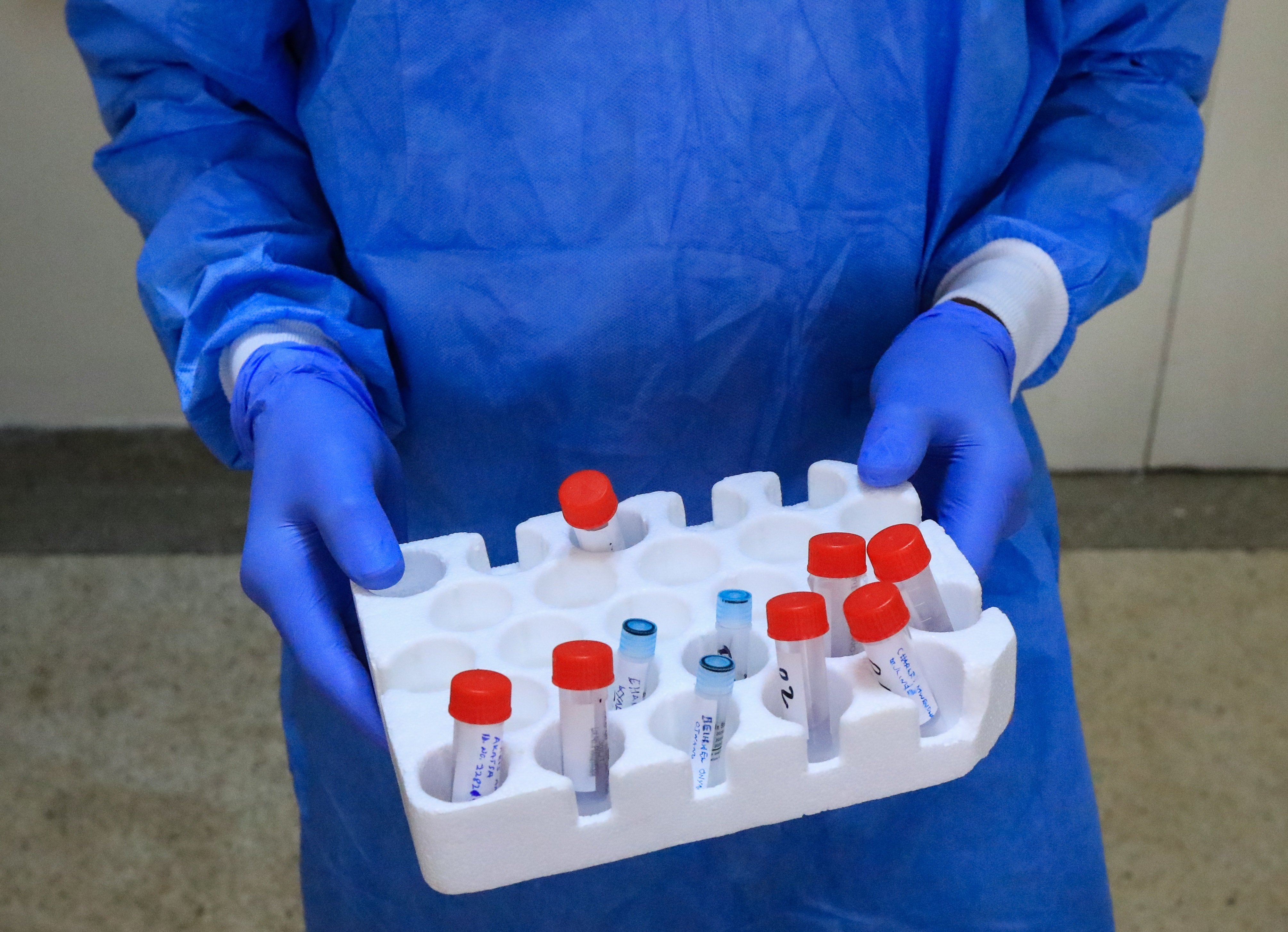 La Xina publica el primer assaig clínic d'una vacuna fiable pel coronavirus