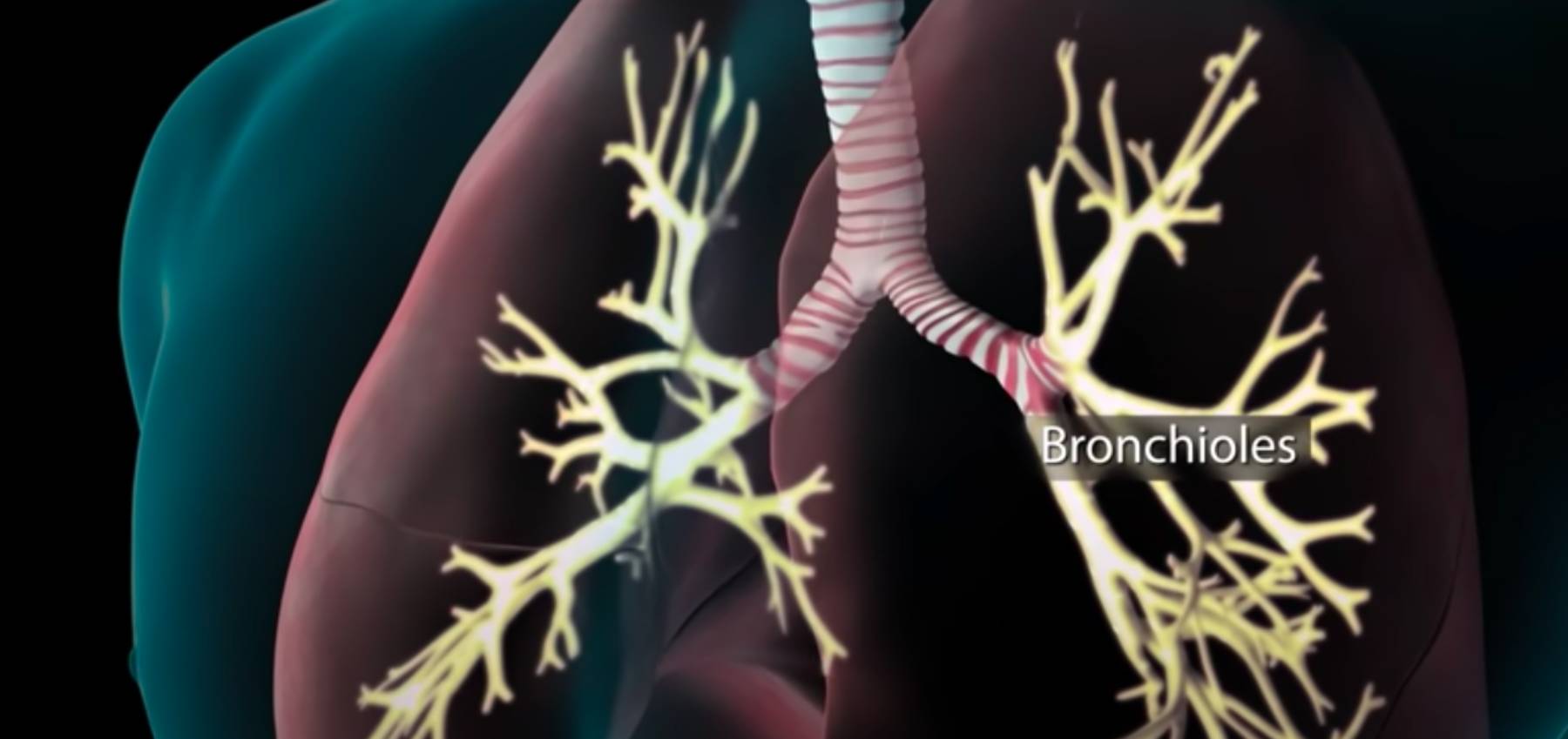 Vídeo | Eso es lo que le pasa a tu cuerpo cuando tienes coronavirus