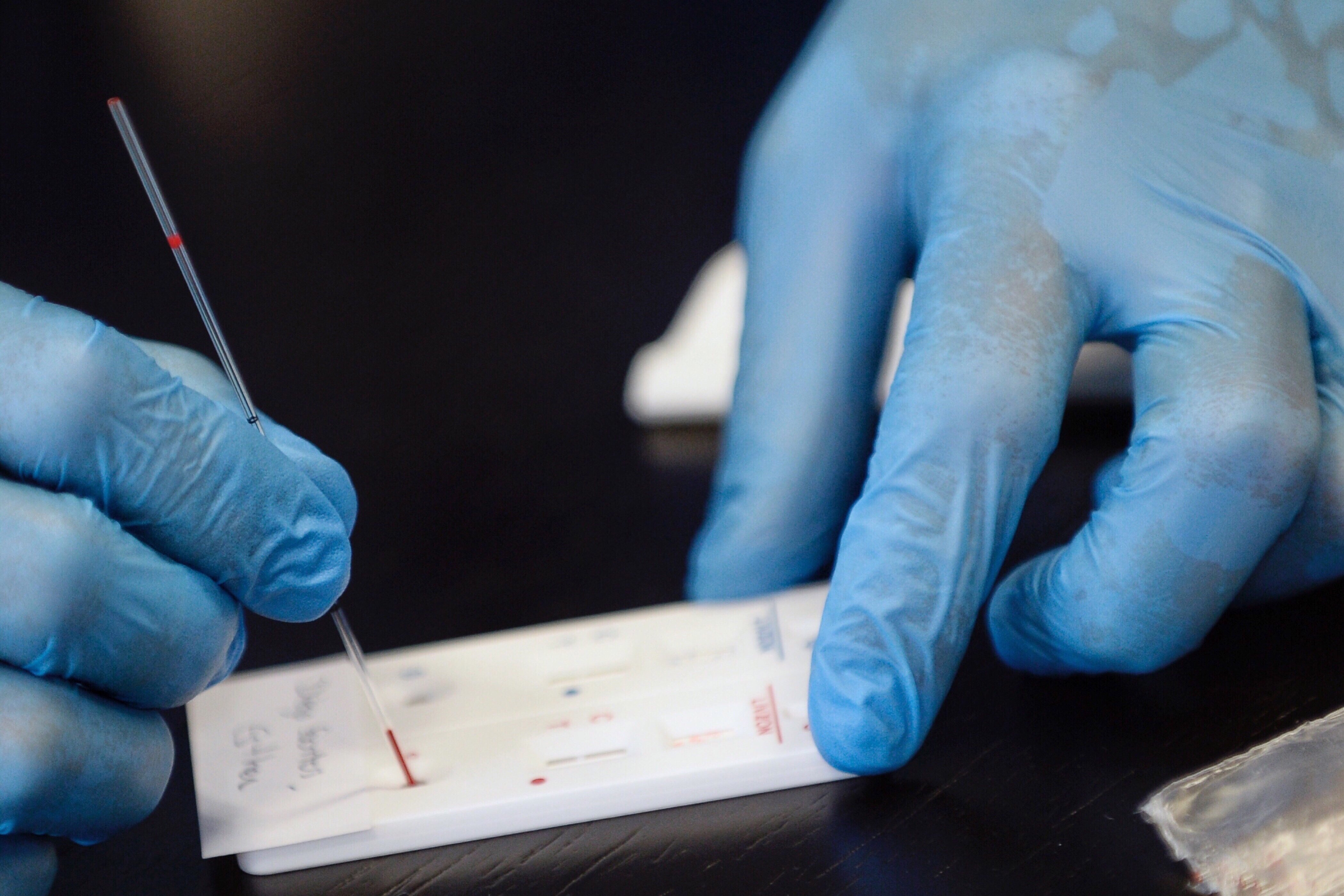 Per què no s'han fet tests serològics fins ara?