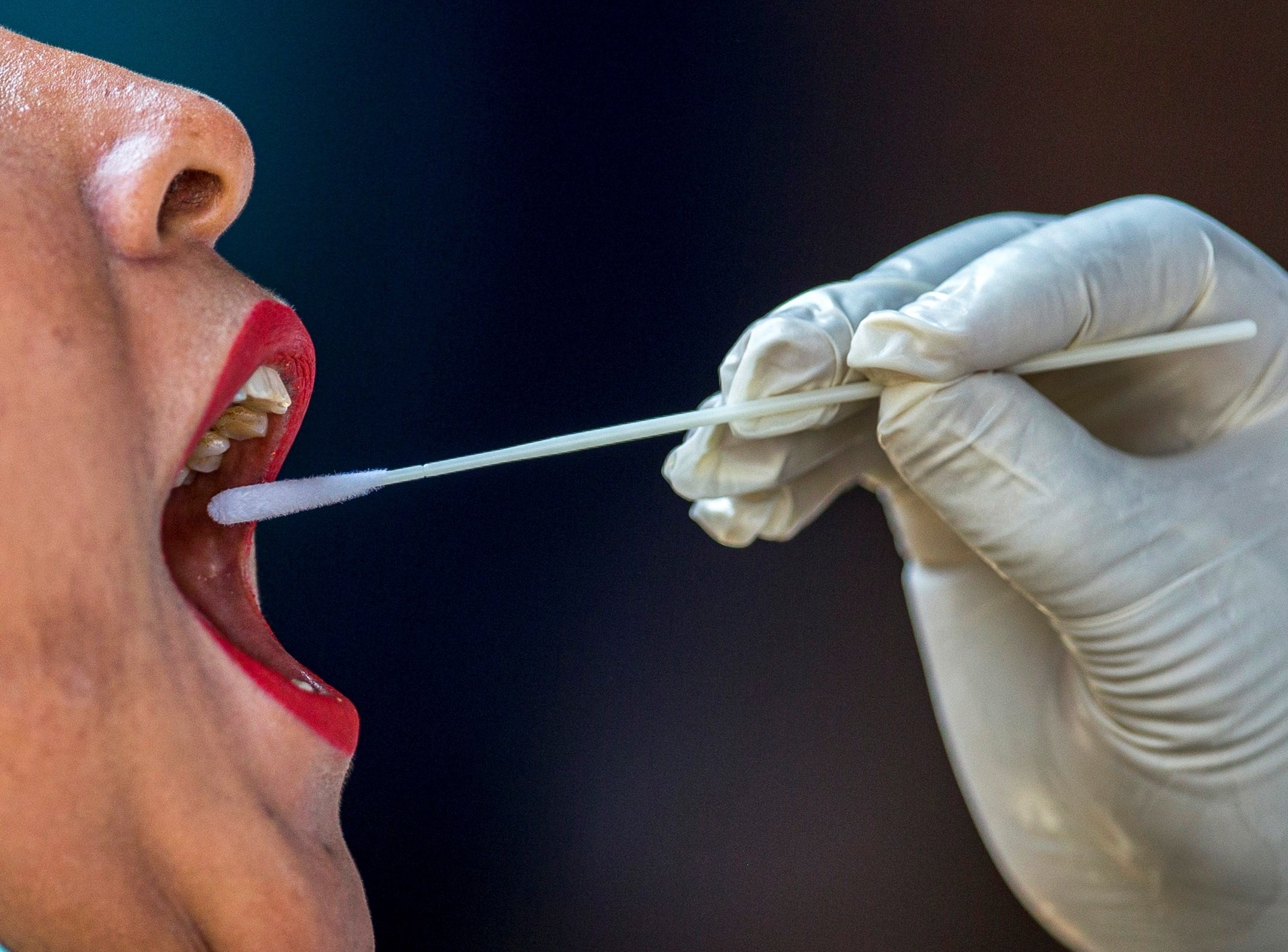 Un 44% d'infectats per coronavirus no queden immunitzats, segons un estudi