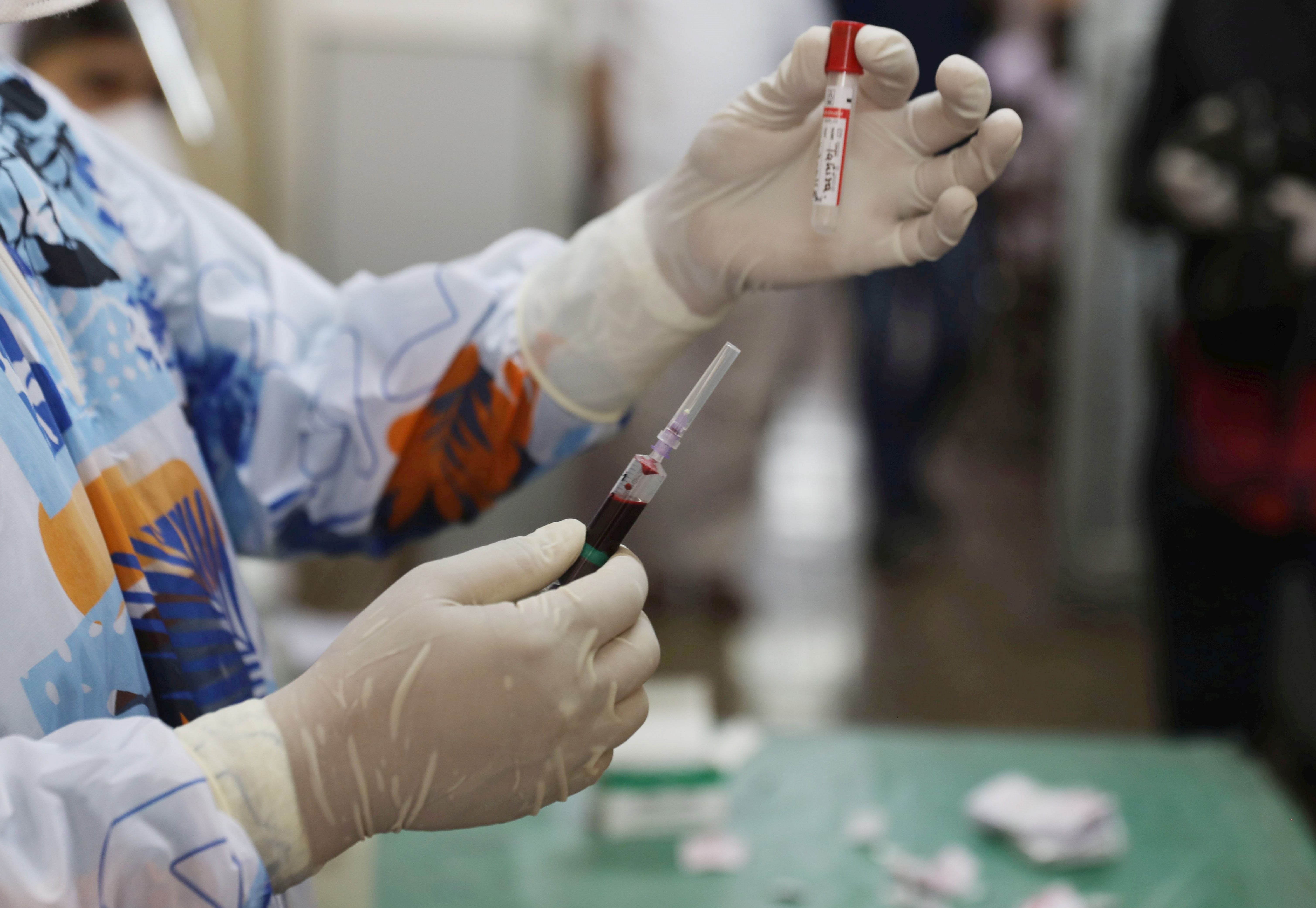 Salut confirma 4 morts per coronavirus a Catalunya i 154 nous contagis