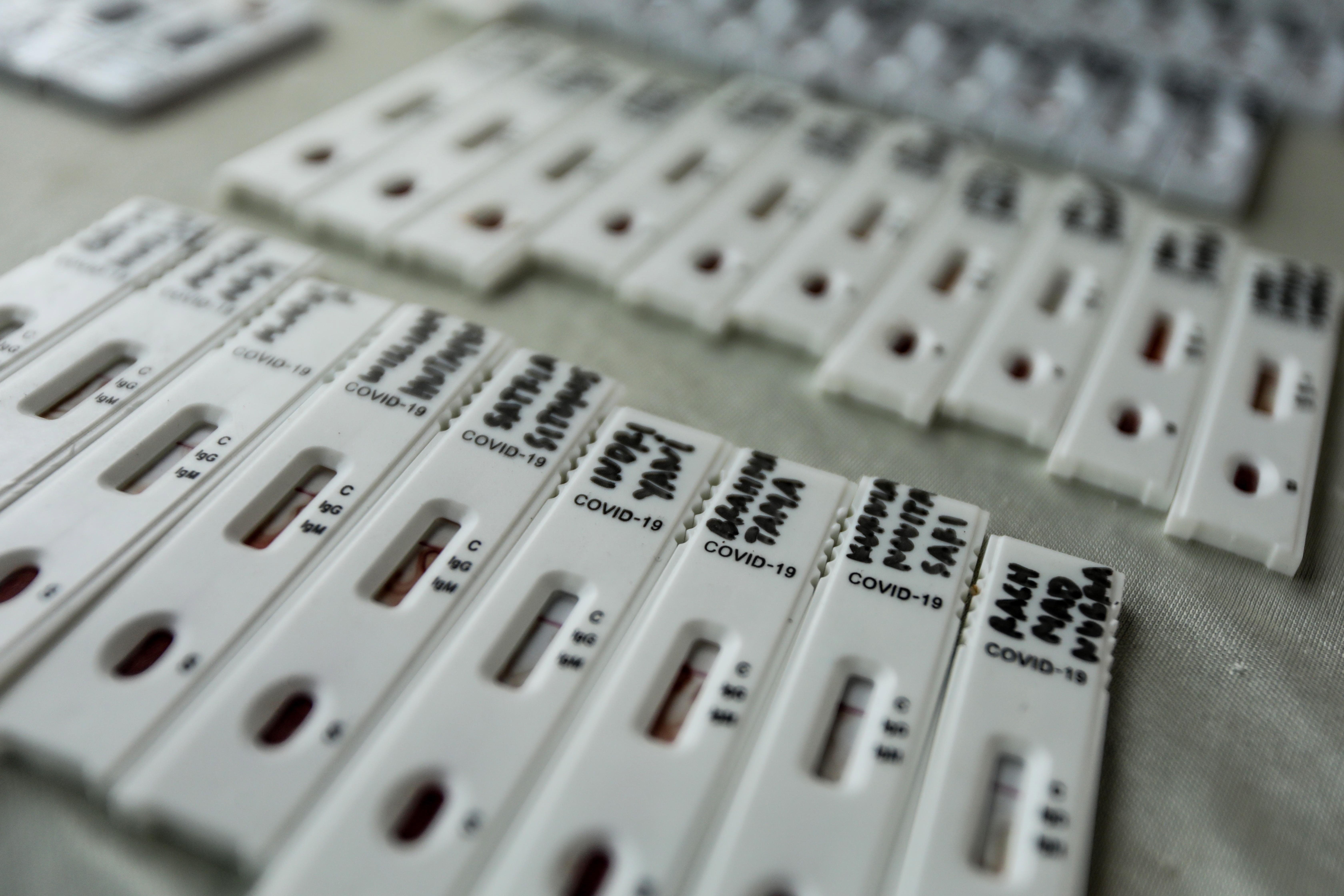 Salut notifica 10 muertos por coronavirus en Catalunya y 91 nuevos contagios