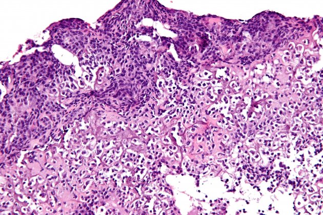 Célula de osteosarcoma