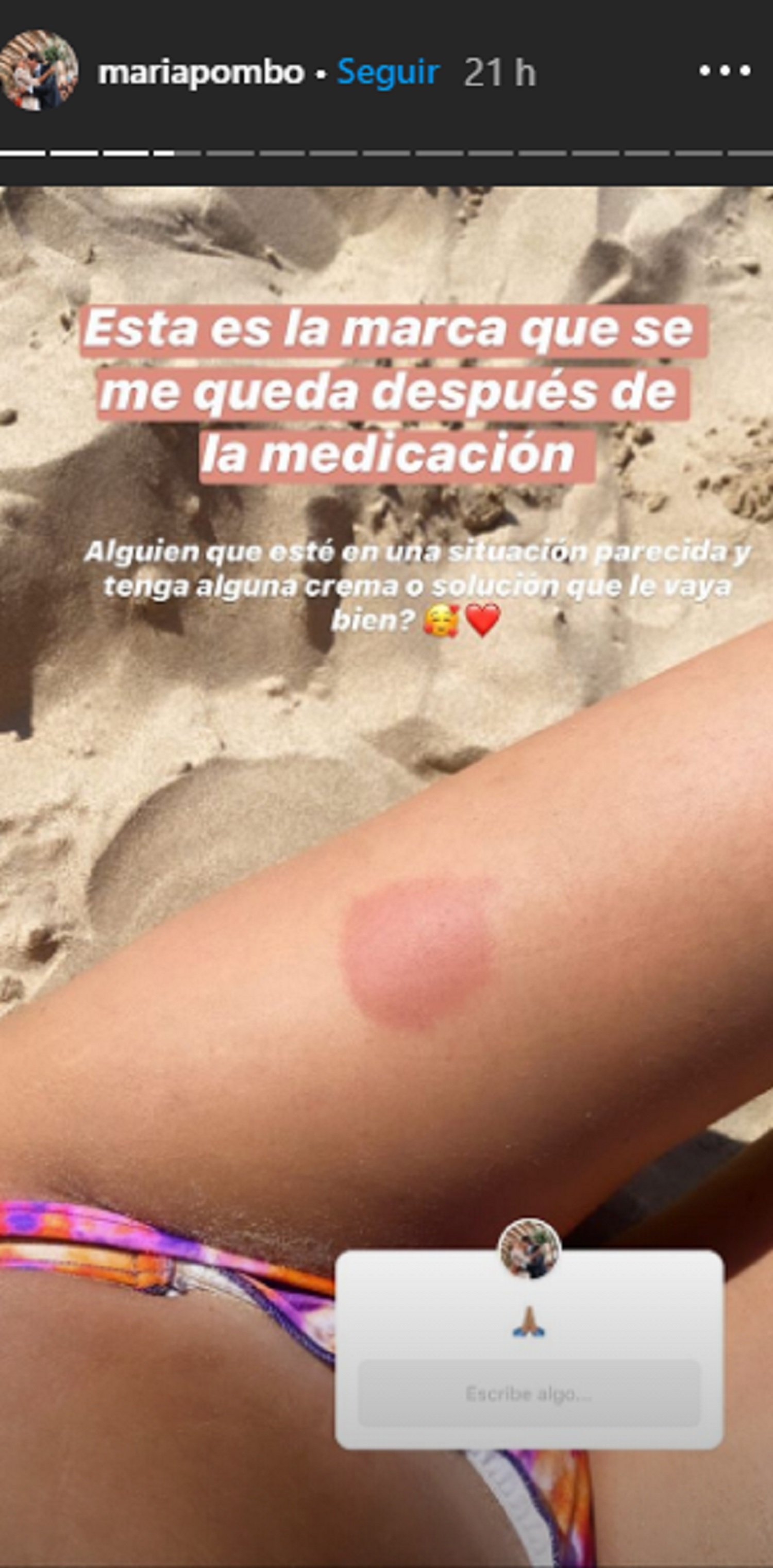 Maria Pombo inyección pierna esclerosis múltiple