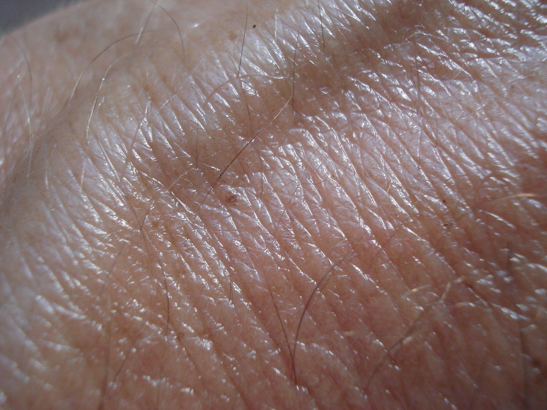 Càncer de pell: detectar-lo a temps és clau